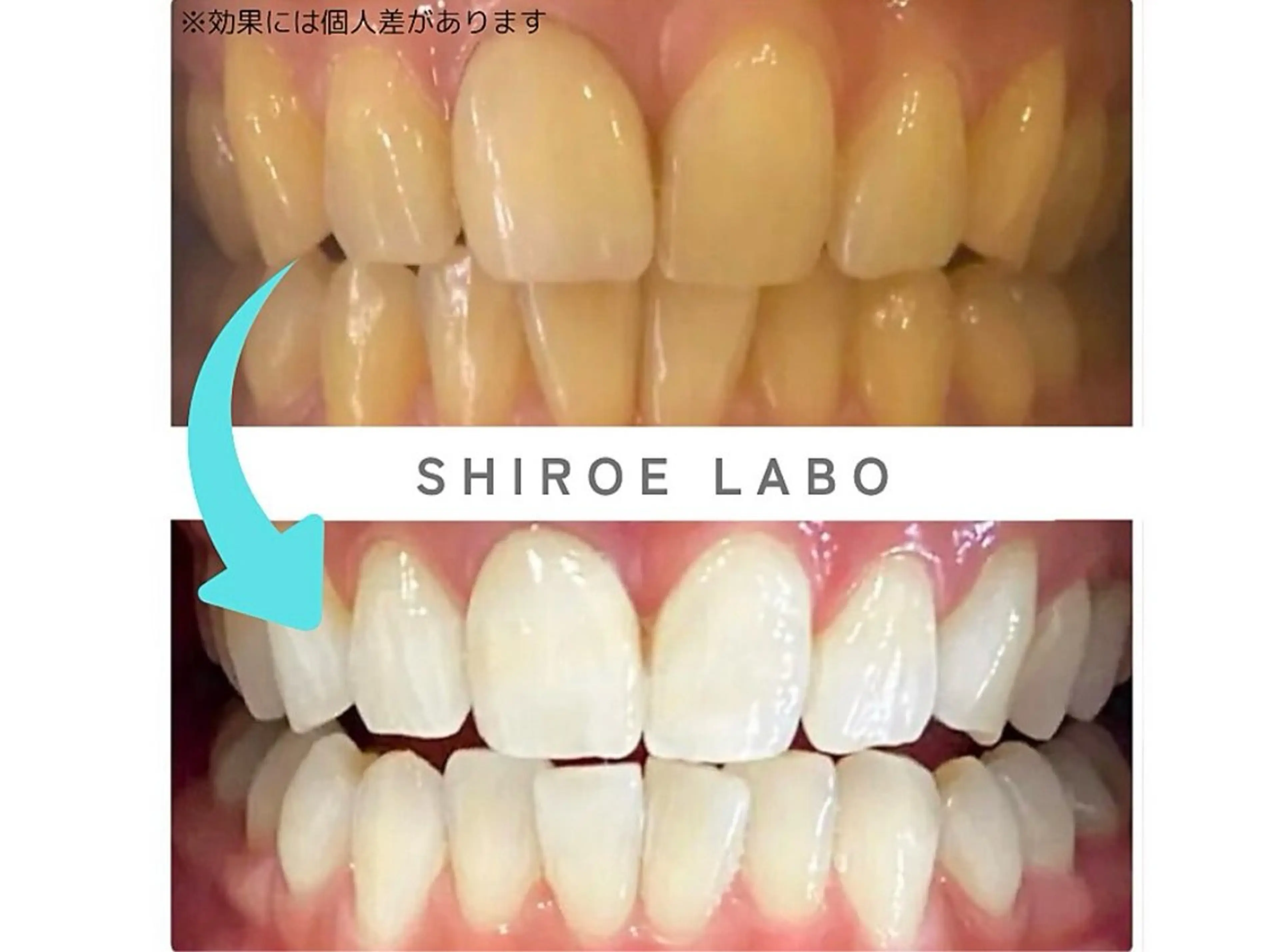 【歯のホワイトニング専門店】シロエラボ梅田店所属・シロエラボ 梅田店のその他イメージ