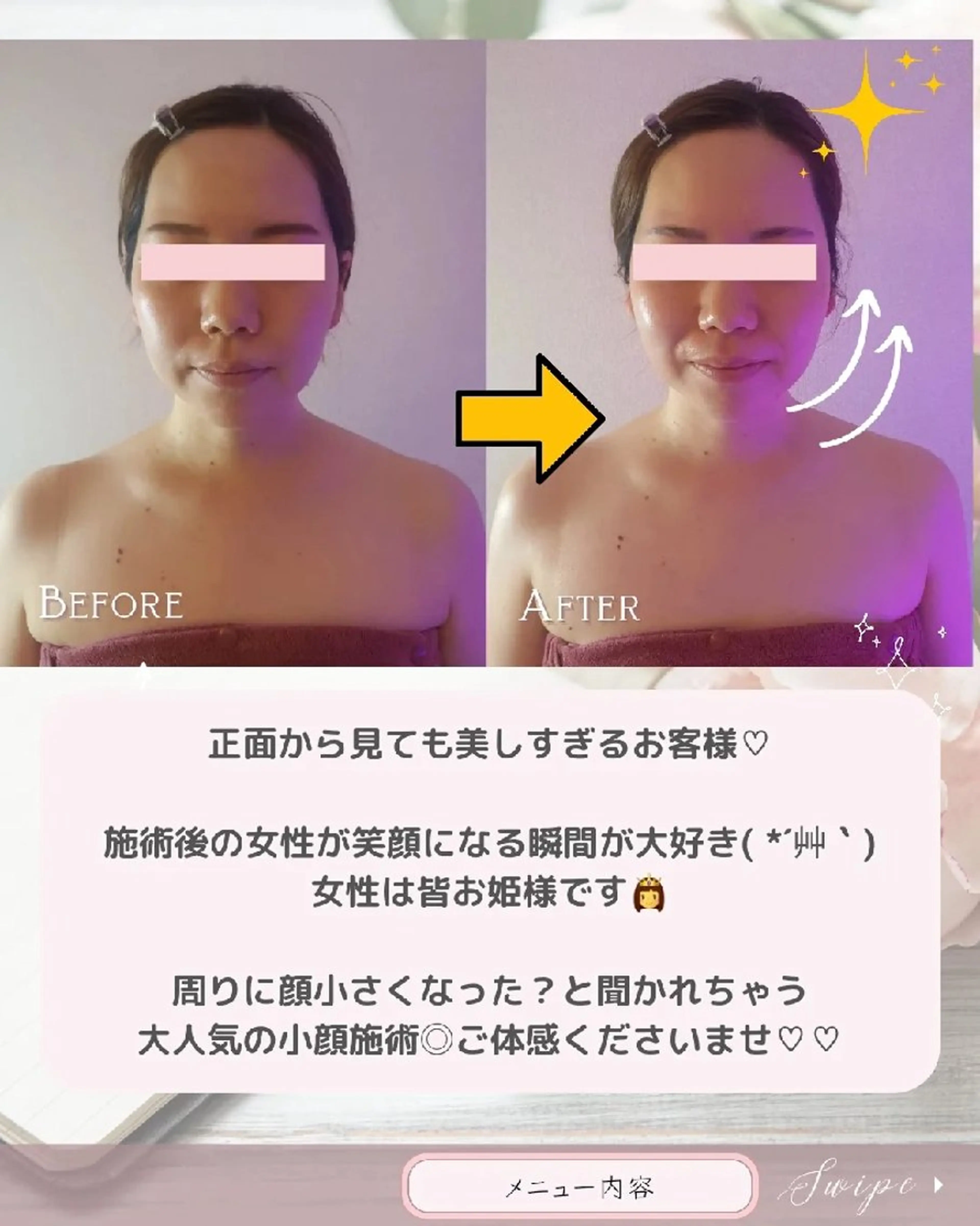 痩身ハーブピーリング 筋膜リリース☆B&Hのエステ・リラクイメージ