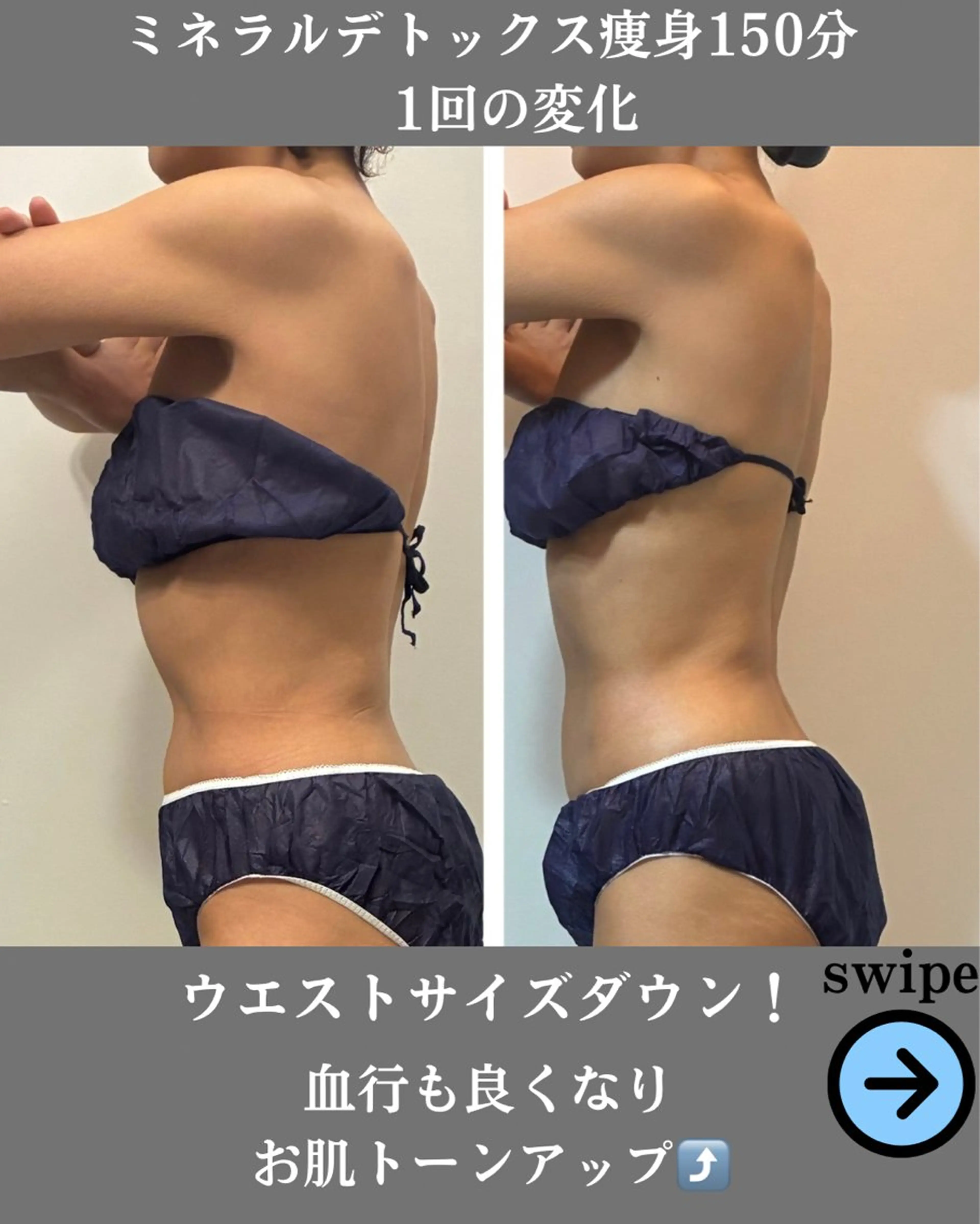 エステ デトックス×ボディメンテナンスサロンShikhara（シカラ）所属・オールハンド筋膜痩身 整体/小顔　中山朝美のエステ・リラクイメージ