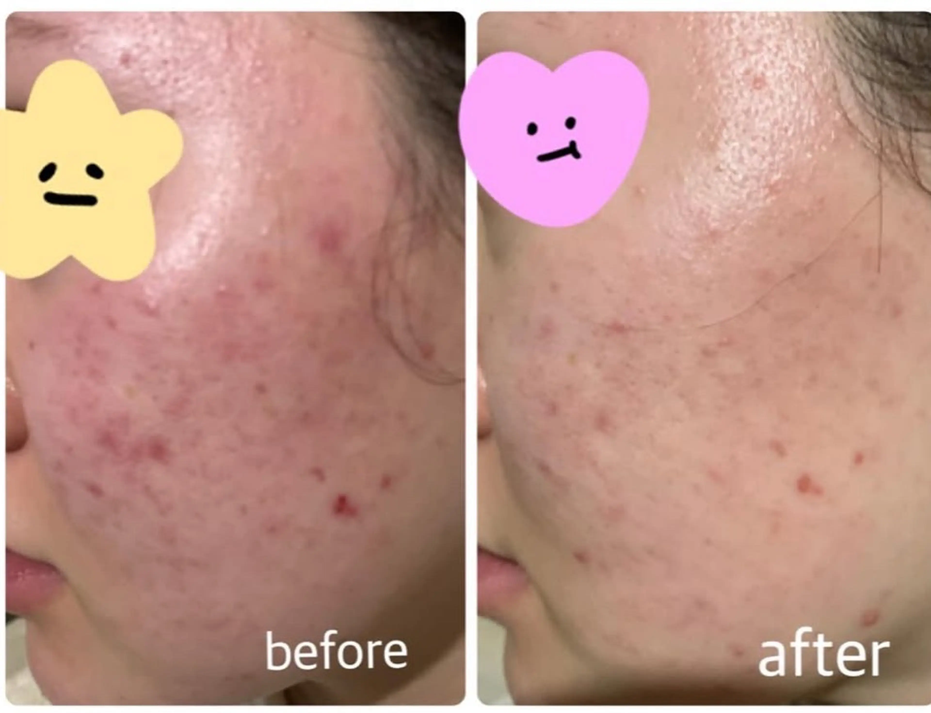 ulu. (ユール)のエステ・リラクイメージ