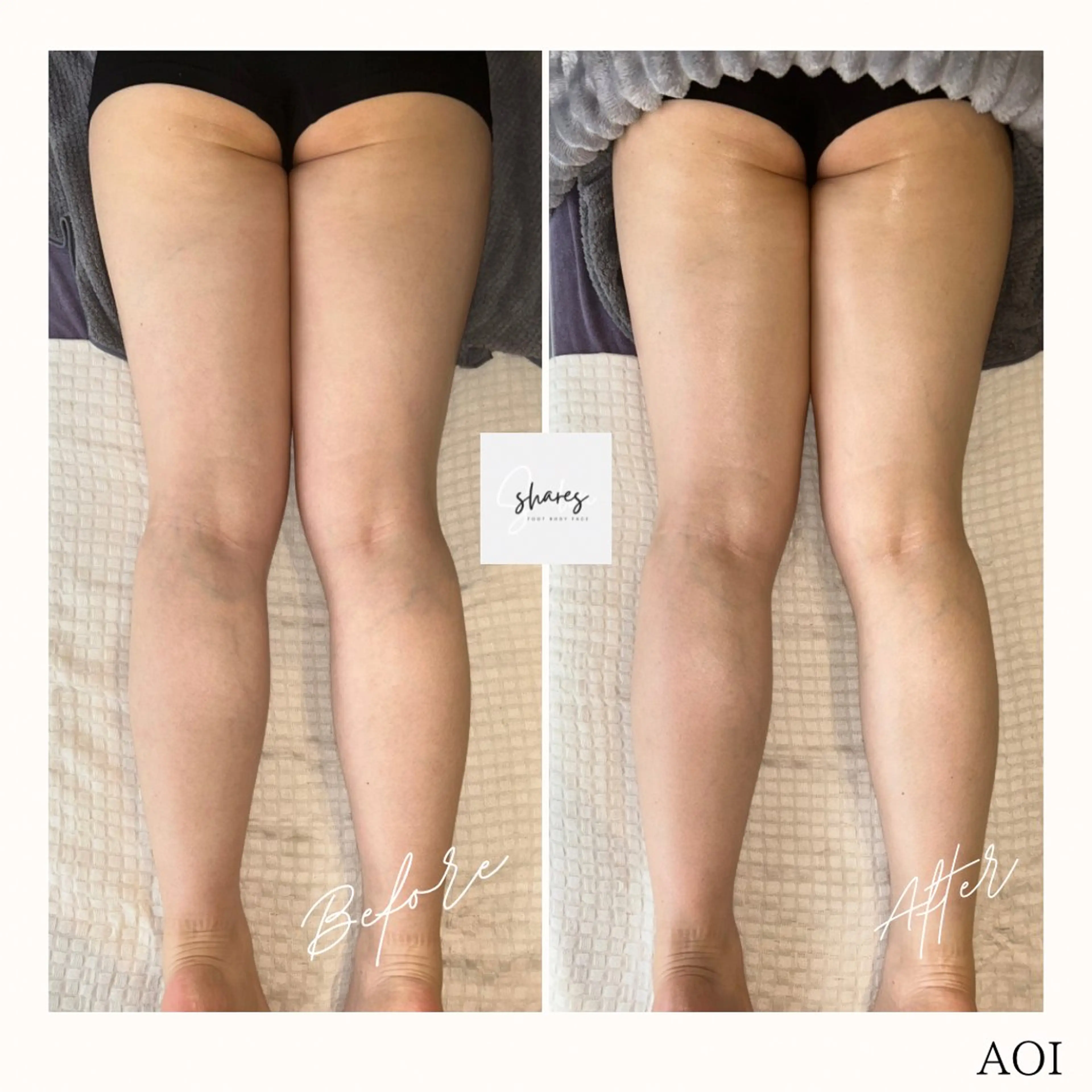 salon shares 辻堂店所属・SHARES AOIのエステ・リラクイメージ