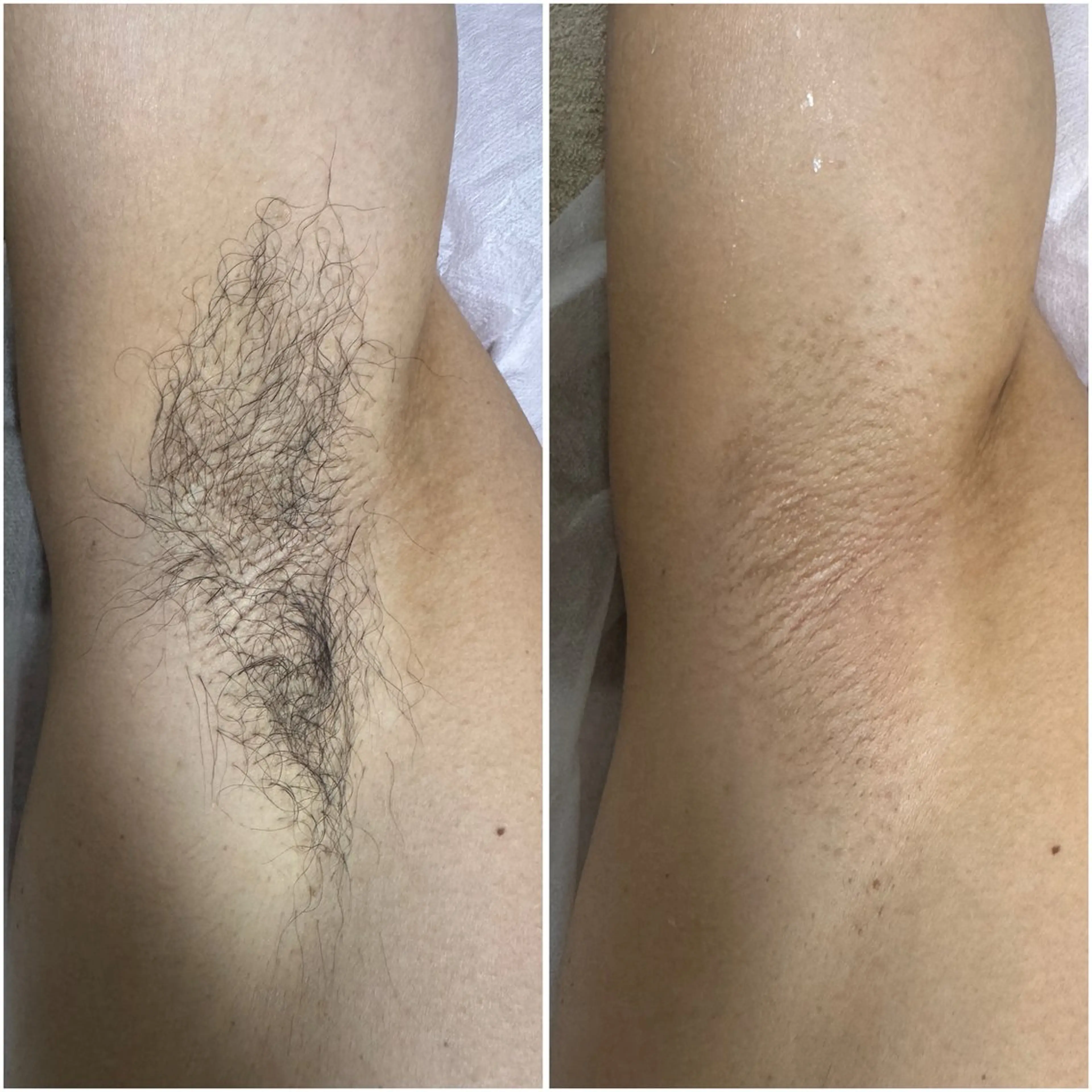 エステ yuuri. Sの眉毛・アイブロウイメージ