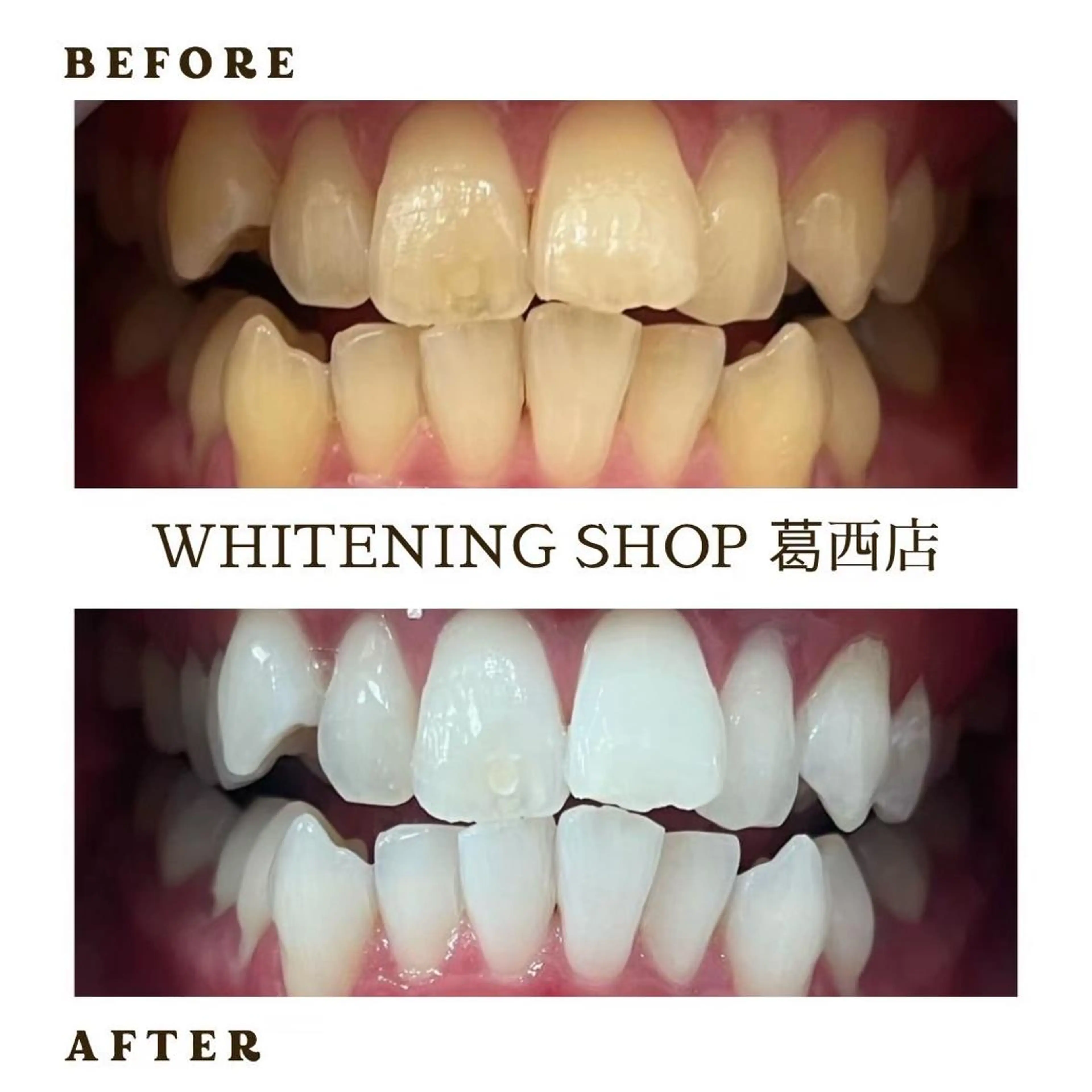 その他 ホワイトニング ショップ葛西店のその他イメージ