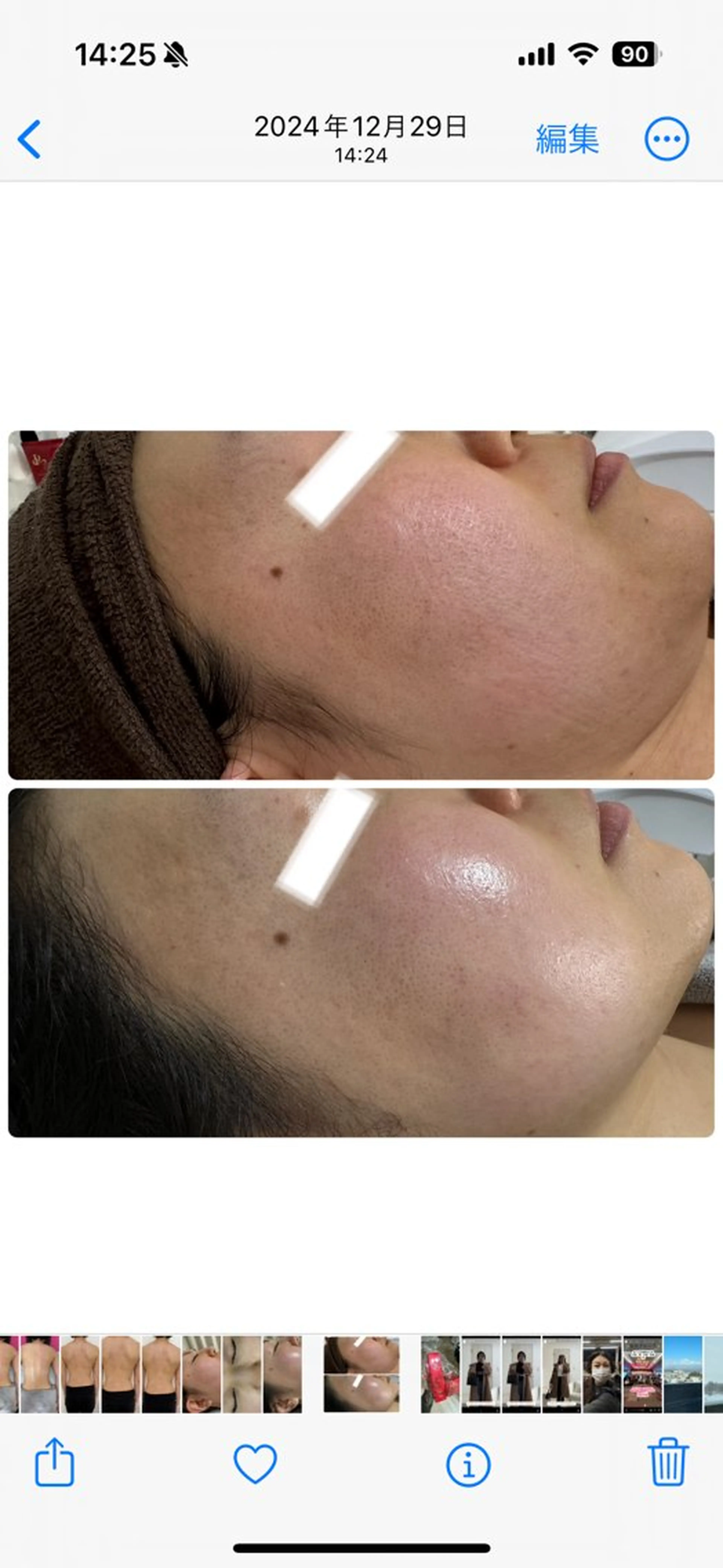 Esthe salon Blanche(エステサロンブランシュ)所属・小顔リフトアップ 美肌改善専門店のエステ・リラクイメージ