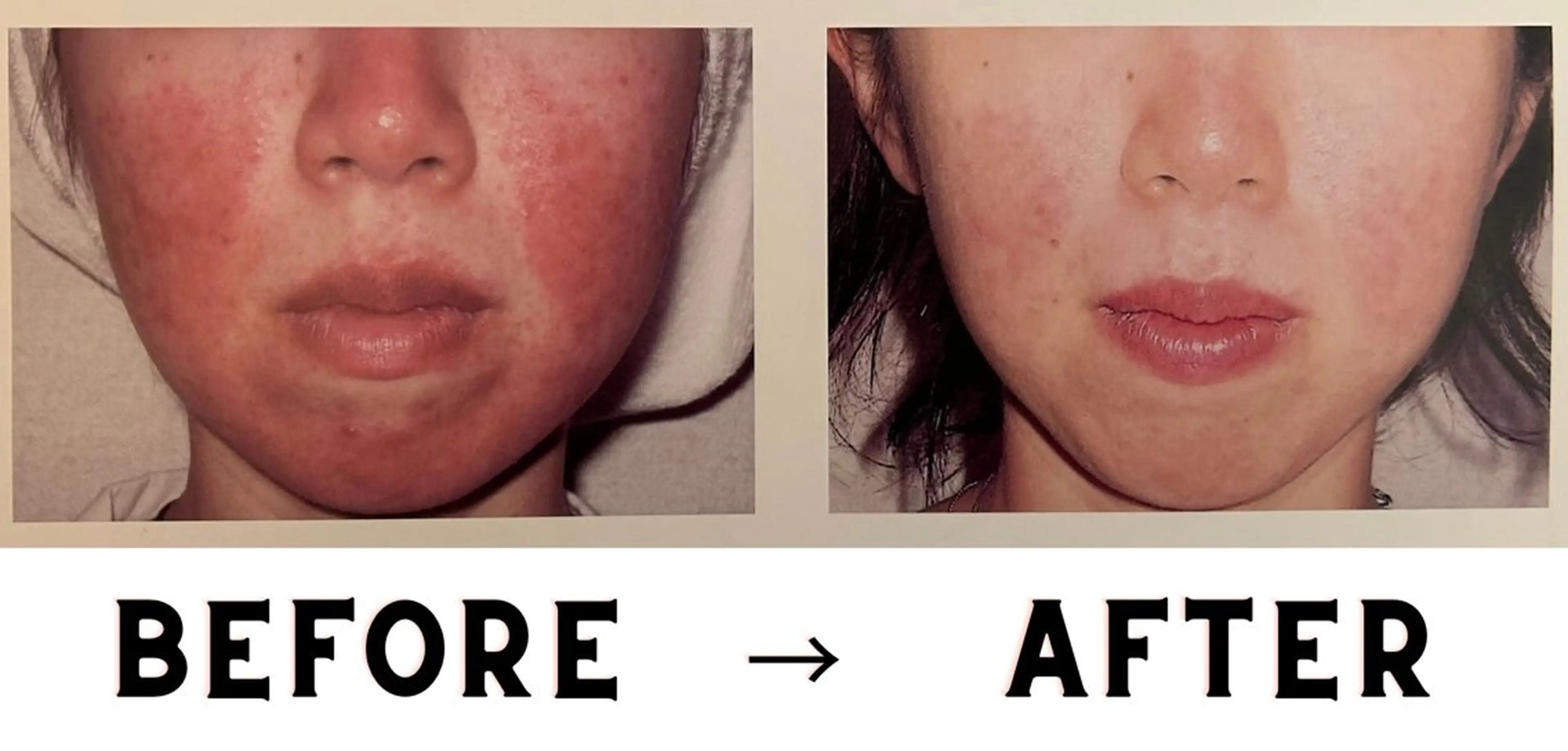 VICTOIRE MARUYAMAのエステ・リラクイメージ