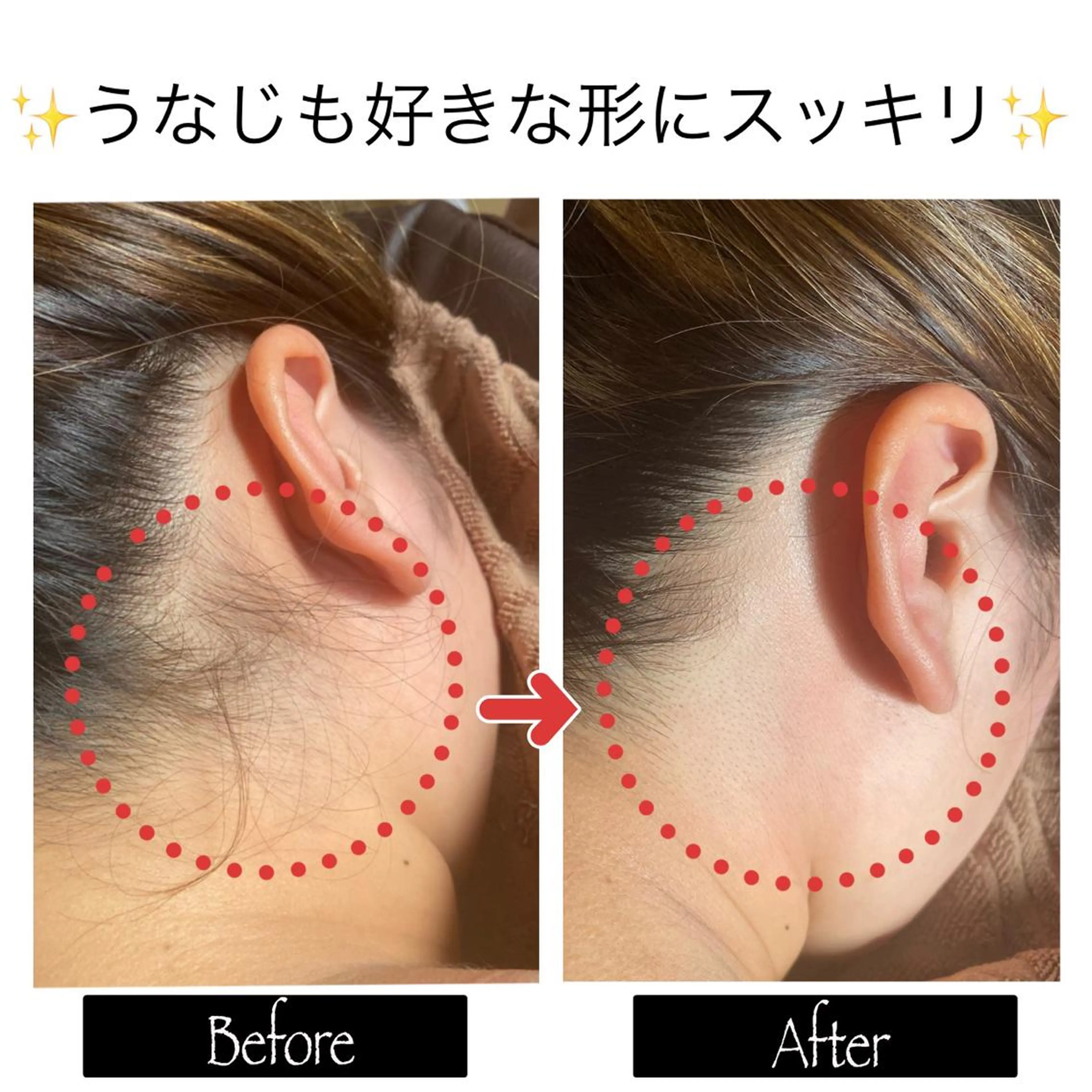 脱毛 脱毛MAX南越谷所属・脱毛MAX 店長まなみのエステ・リラクイメージ