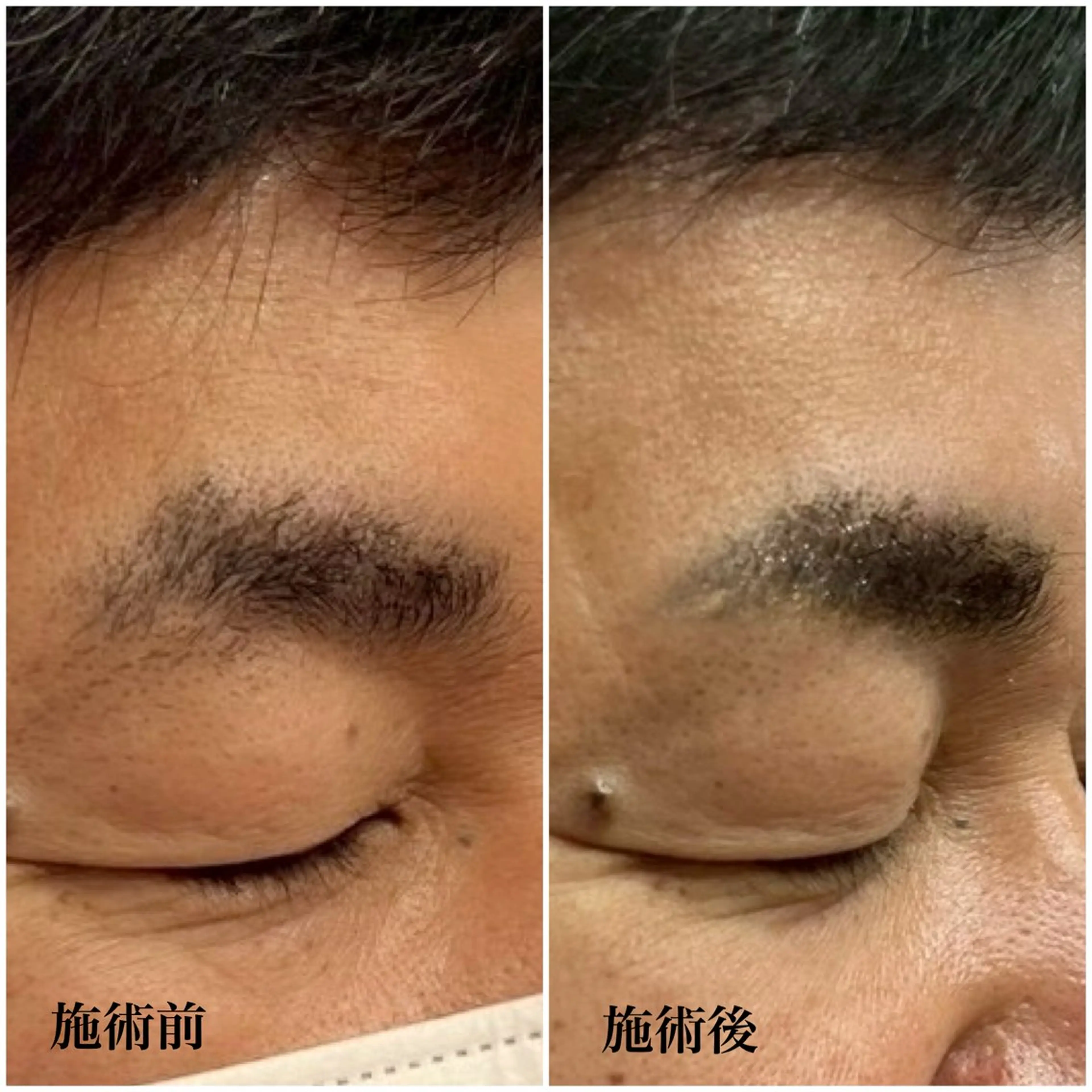 アイブロウ ワックス脱毛 眉カット その他(アイブロウ) NoANoA 名倉の眉毛・アイブロウイメージ