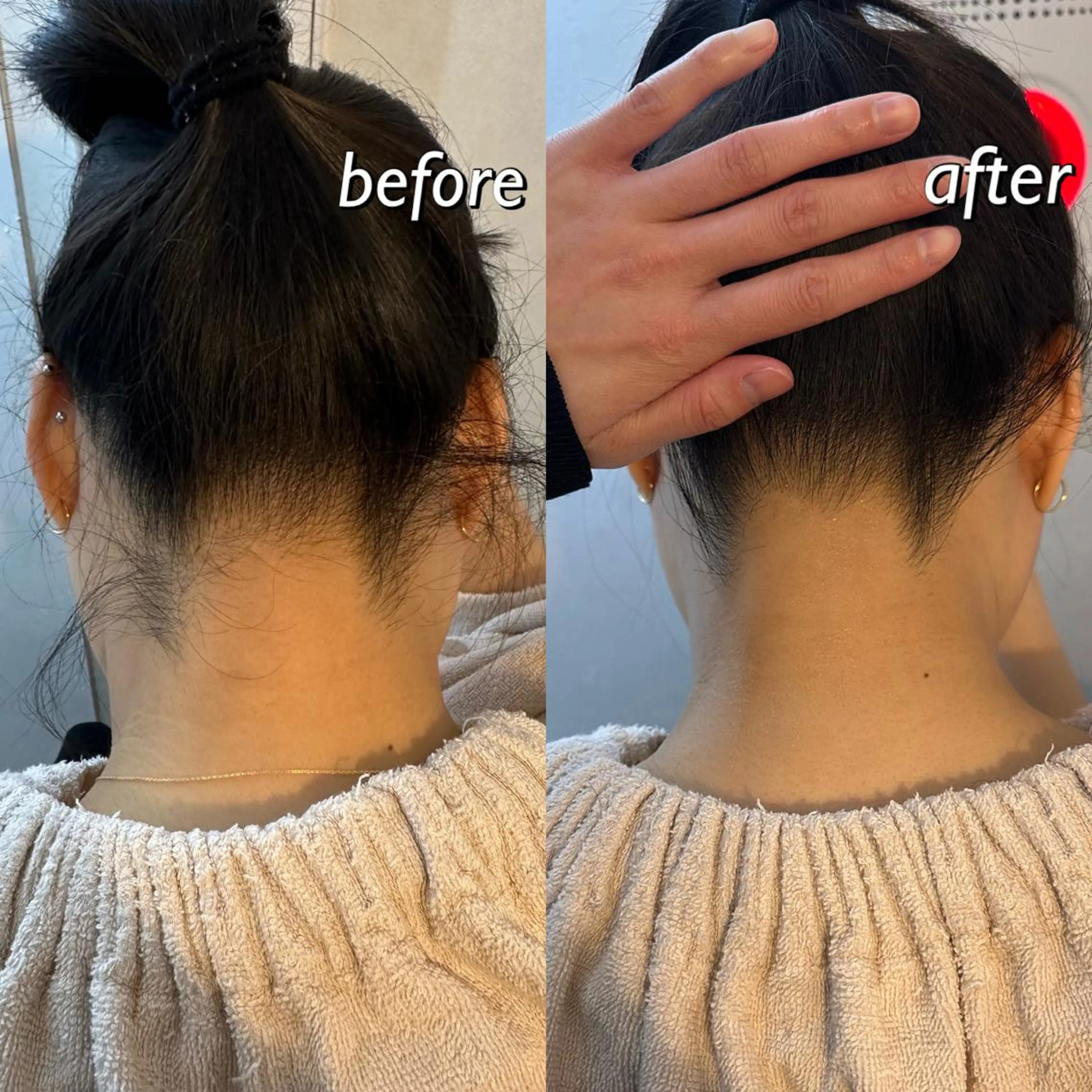 うなじ脱毛/美肌脱毛 LABELのエステ・リラクイメージ