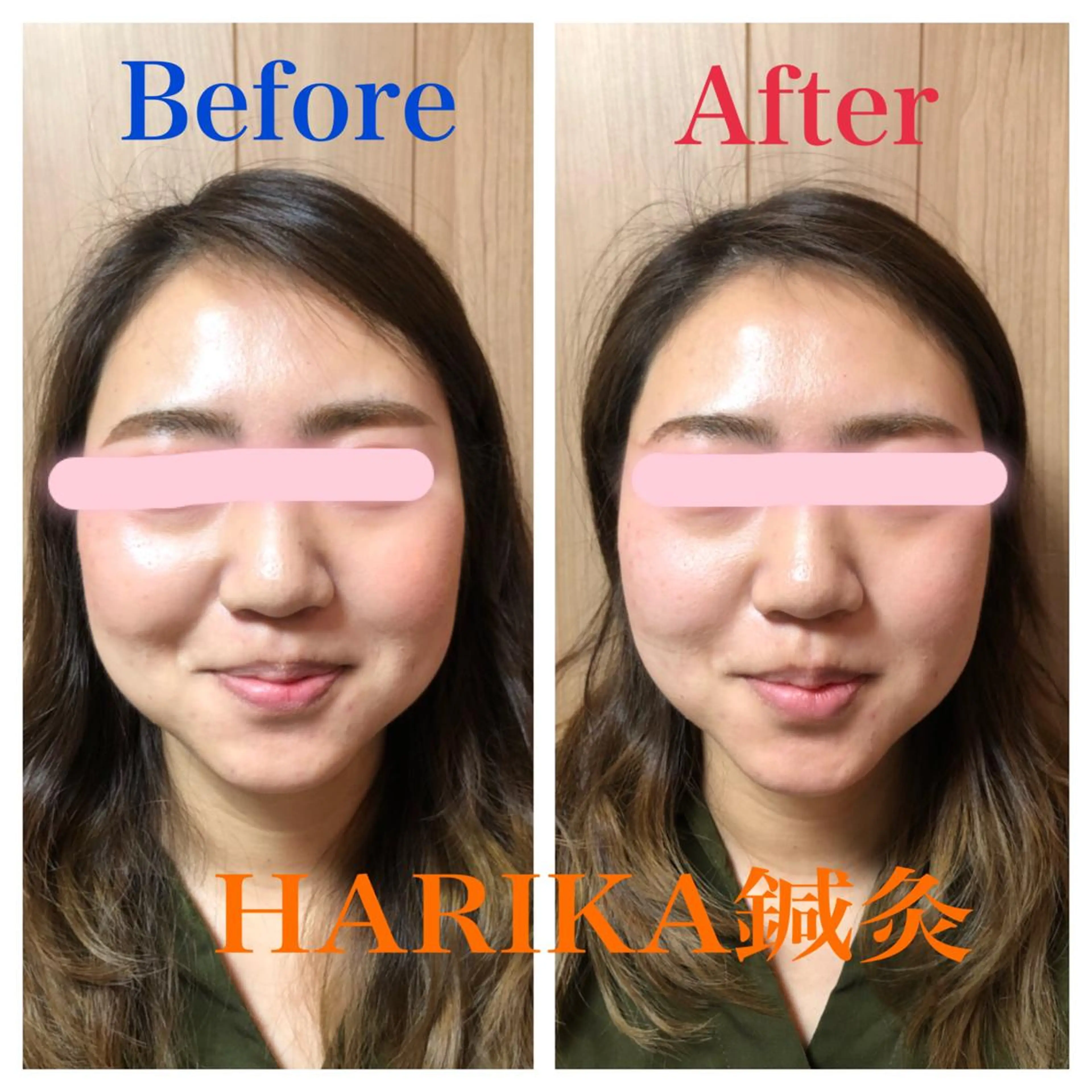 HARIKA鍼灸所属・HARIKA 鍼灸のその他イメージ