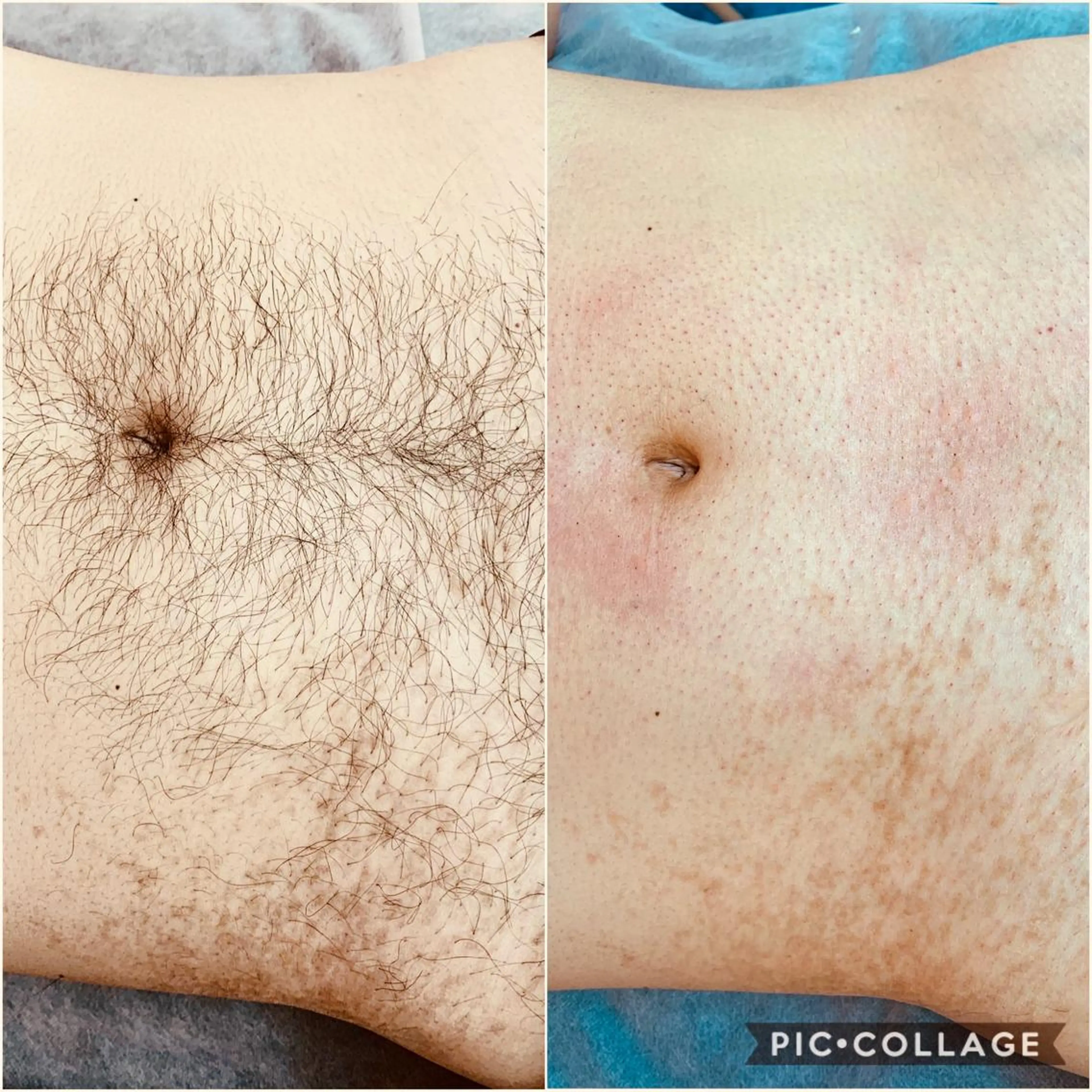 メンズ Laki wax所属・Laki wax chikaのエステ・リラクイメージ