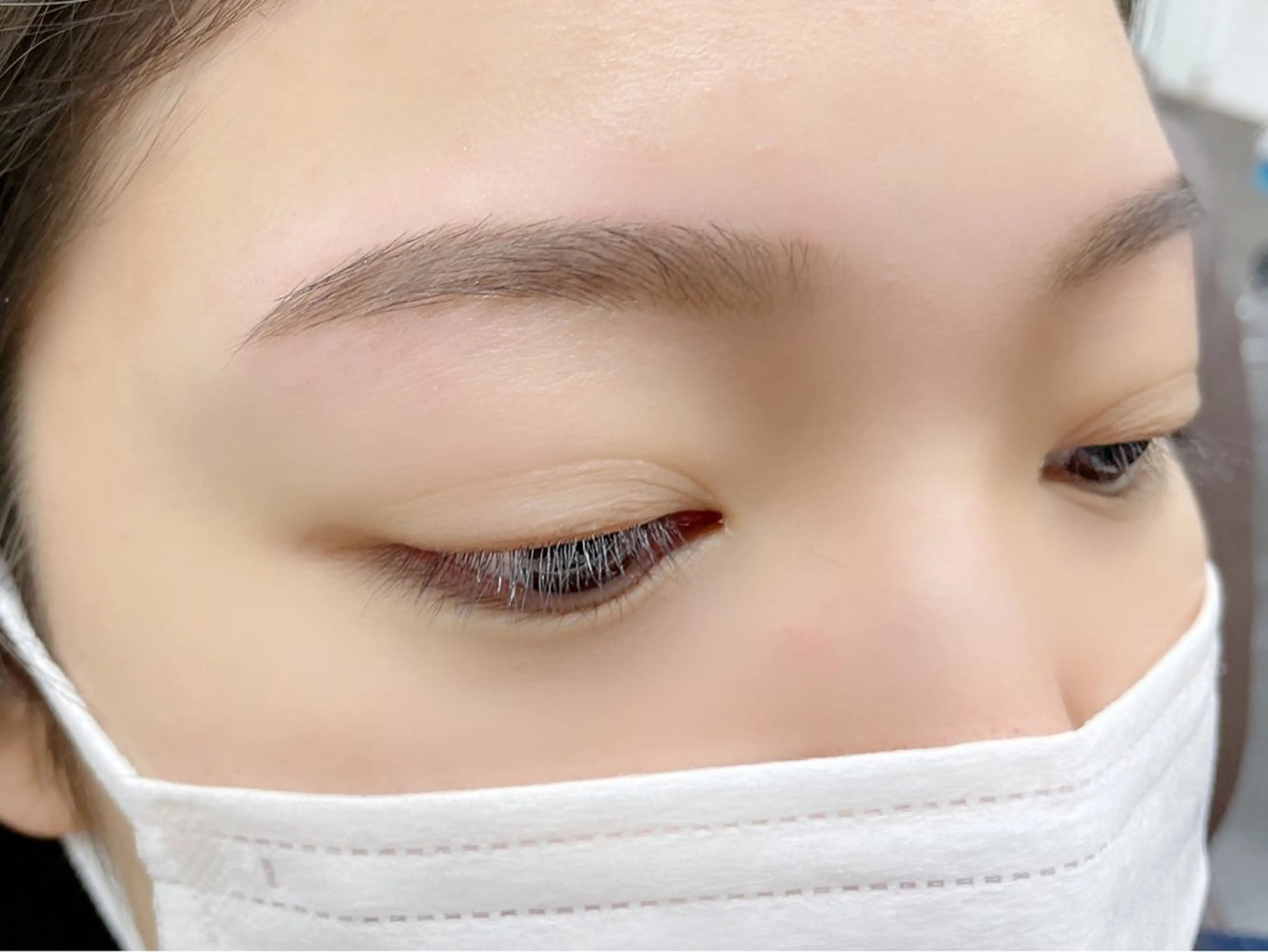 【アイブロウWAX脱毛】眉毛脱毛の写真