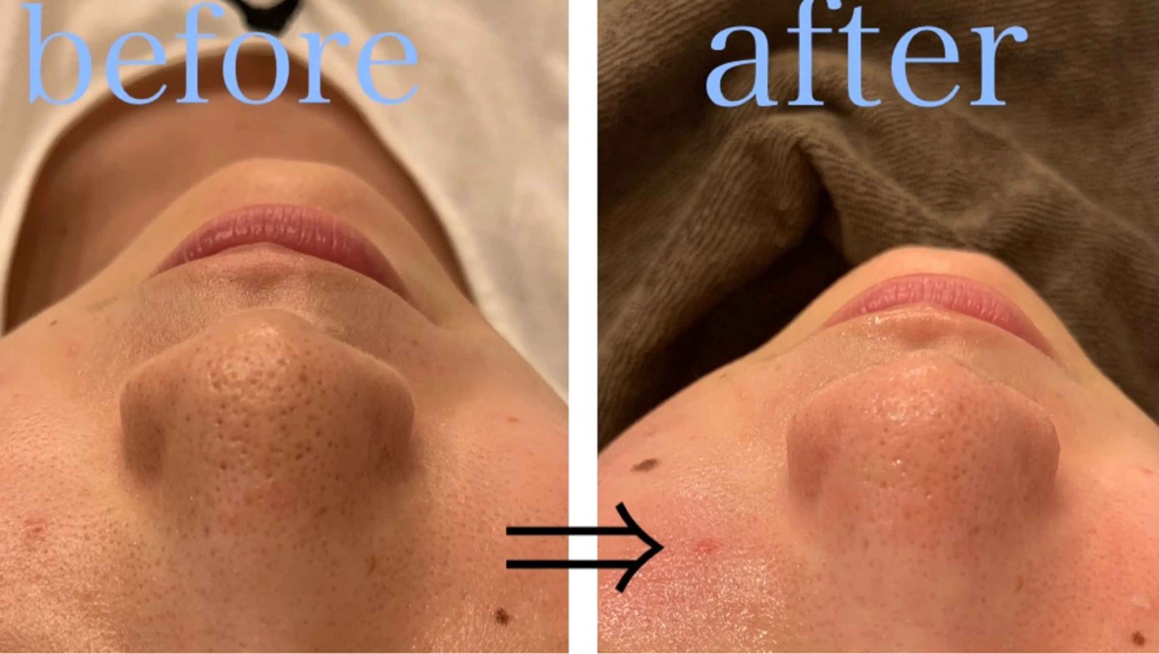 リジュベ所属・Rejuve ﾘｼﾞｭﾍﾞのエステ・リラクイメージ