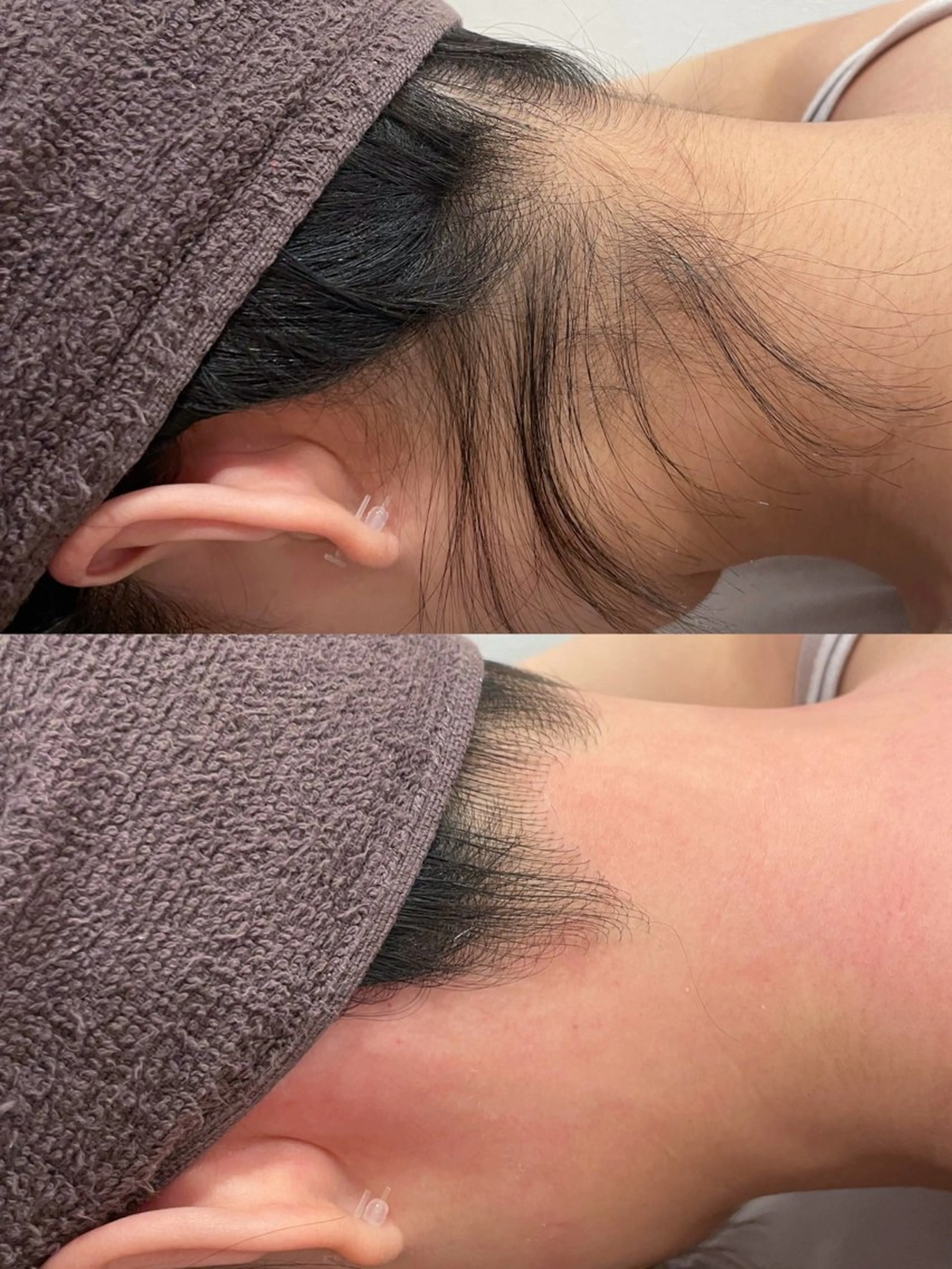 VIO脱毛専門店 kika〜キカ〜所属・【メンズSTART】 VIO専門店kikaのエステ・リラクイメージ