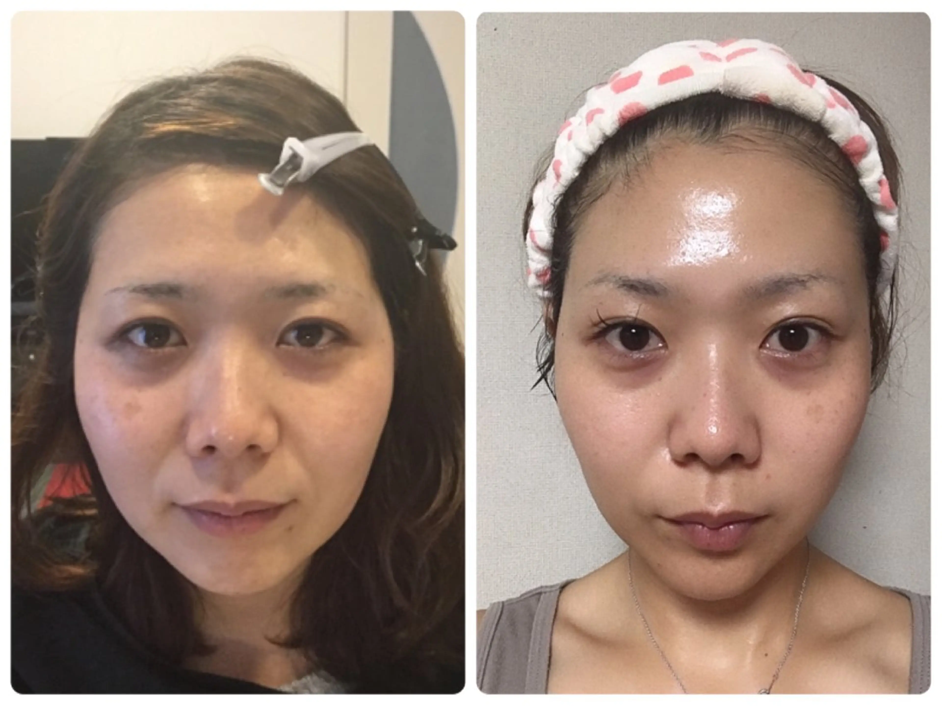 エステ リラク Natura ナトァーラのヘアスタイル