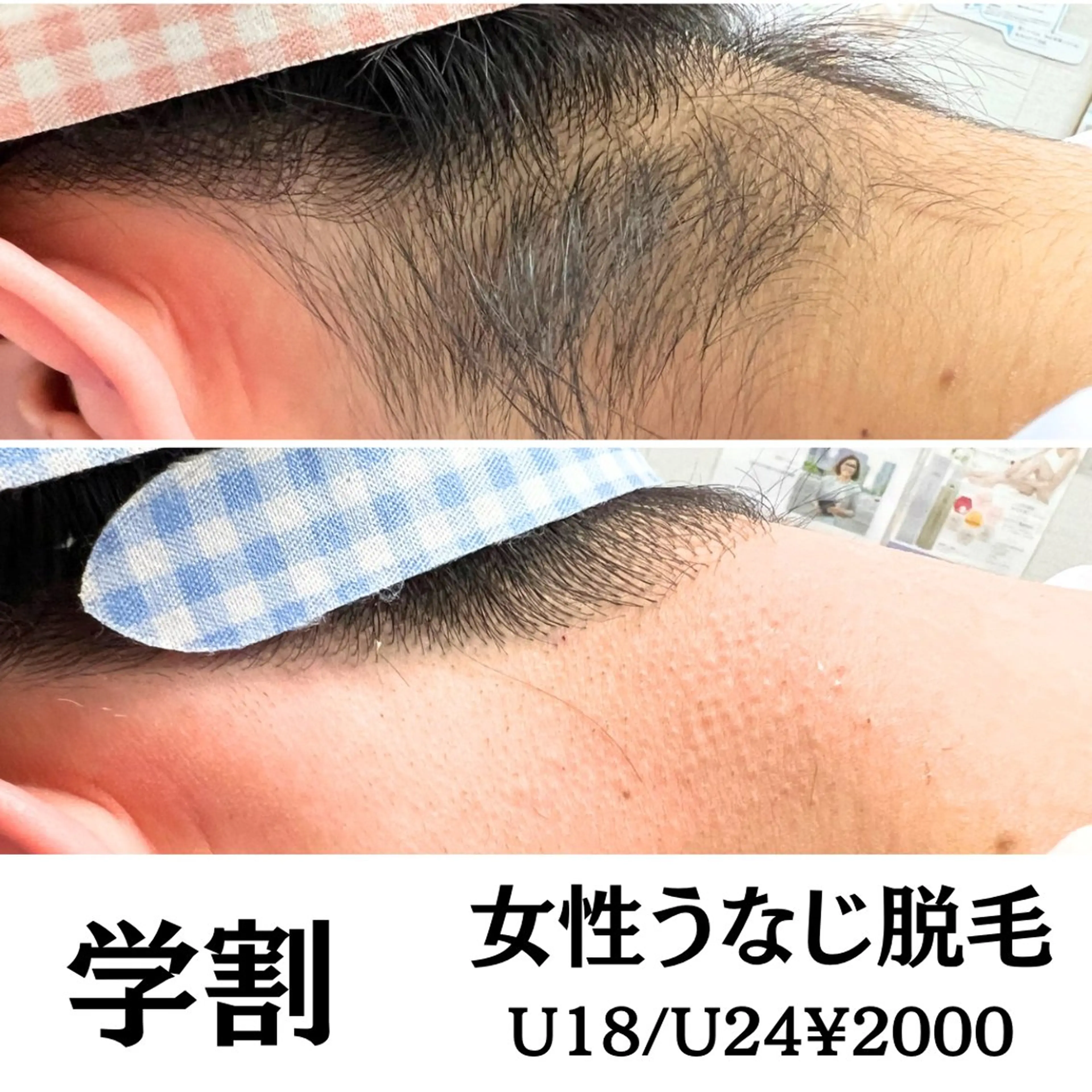 脱毛 🌼SALON Lazuli久留米のエステ・リラクイメージ