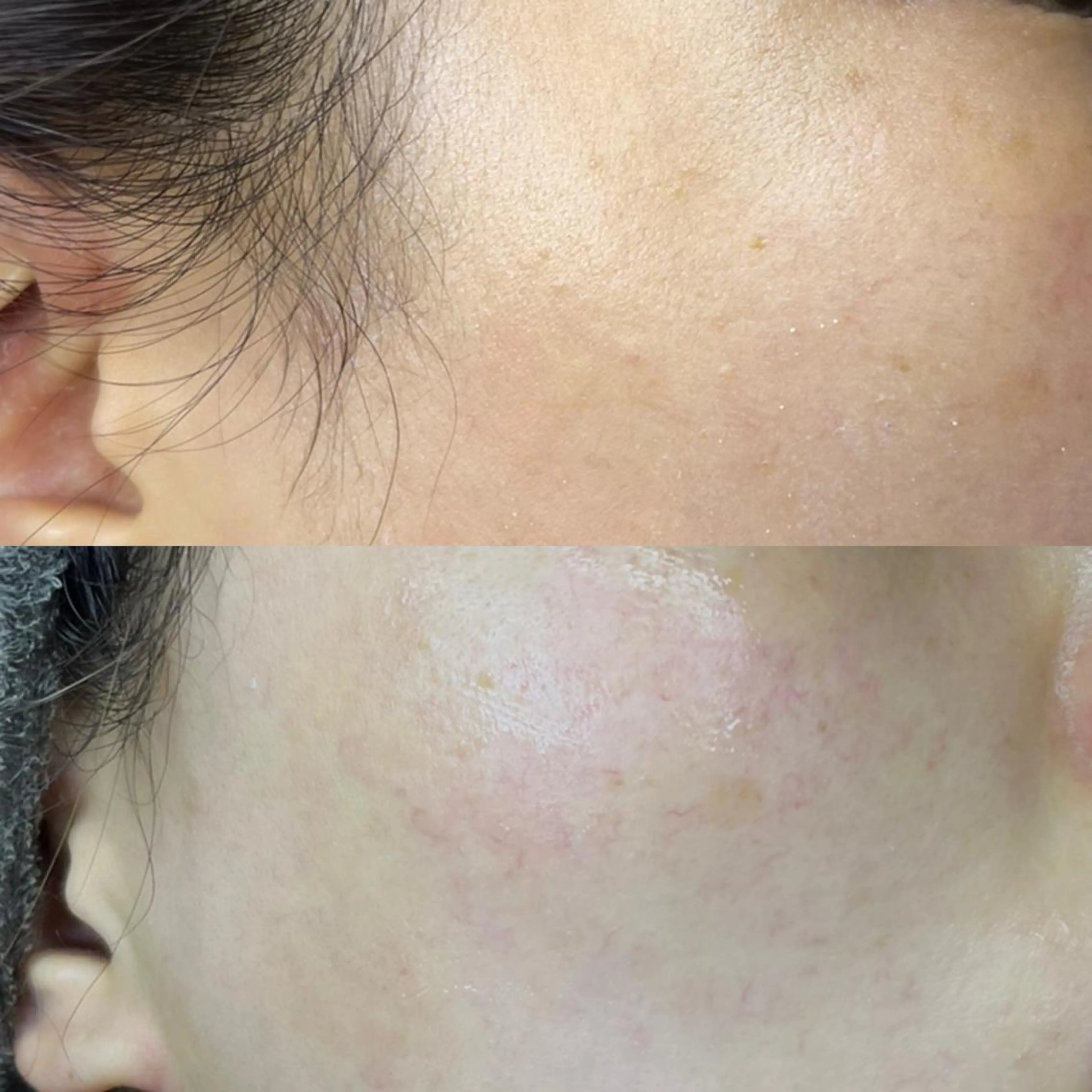 脱毛 眉毛と韓国肌質改善 サロン　和泉府中のエステ・リラクイメージ