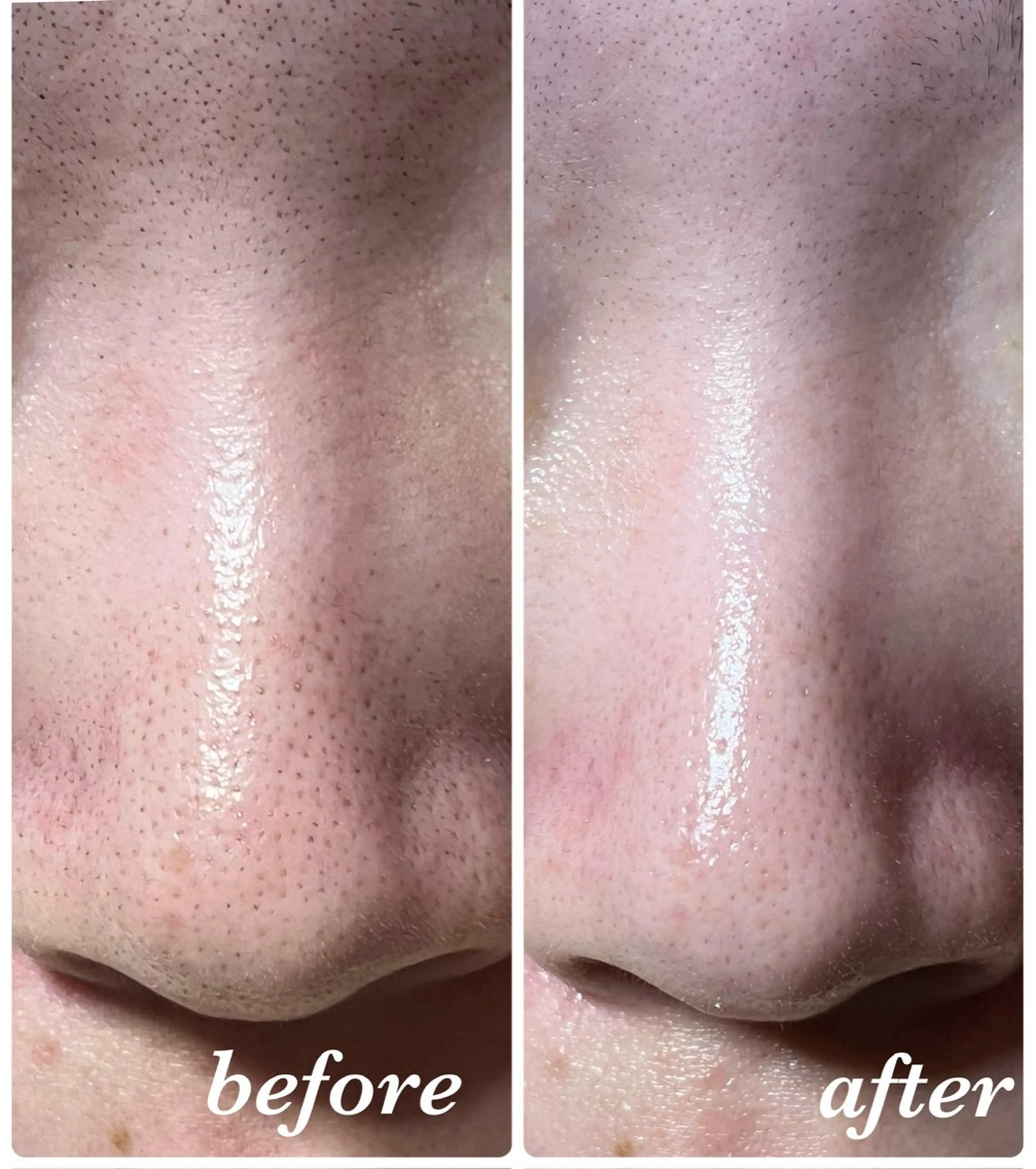 結果重視｜毛穴エステ ｜友綱理恵のエステ・リラクイメージ