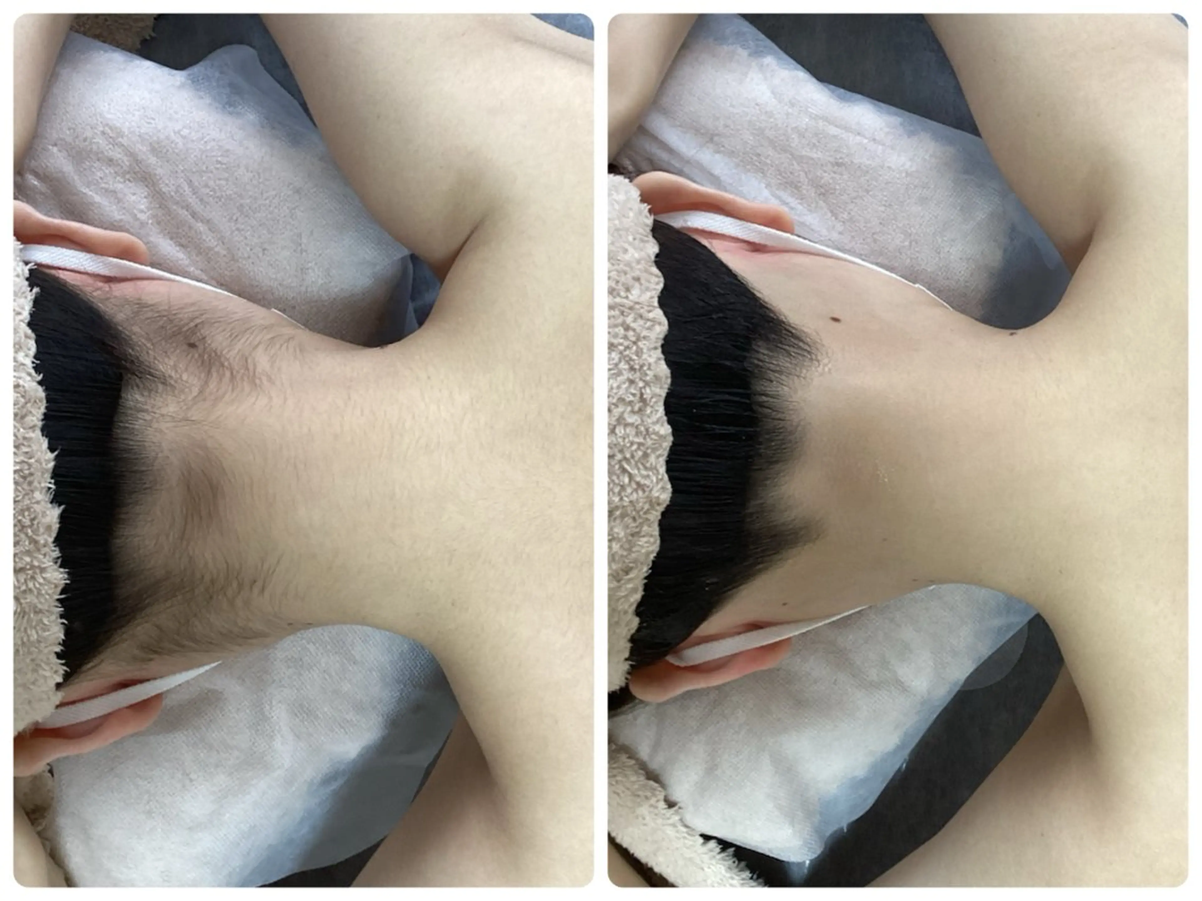 脱毛 脱毛専門減毛サロン LULU.tokyoのエステ・リラクイメージ