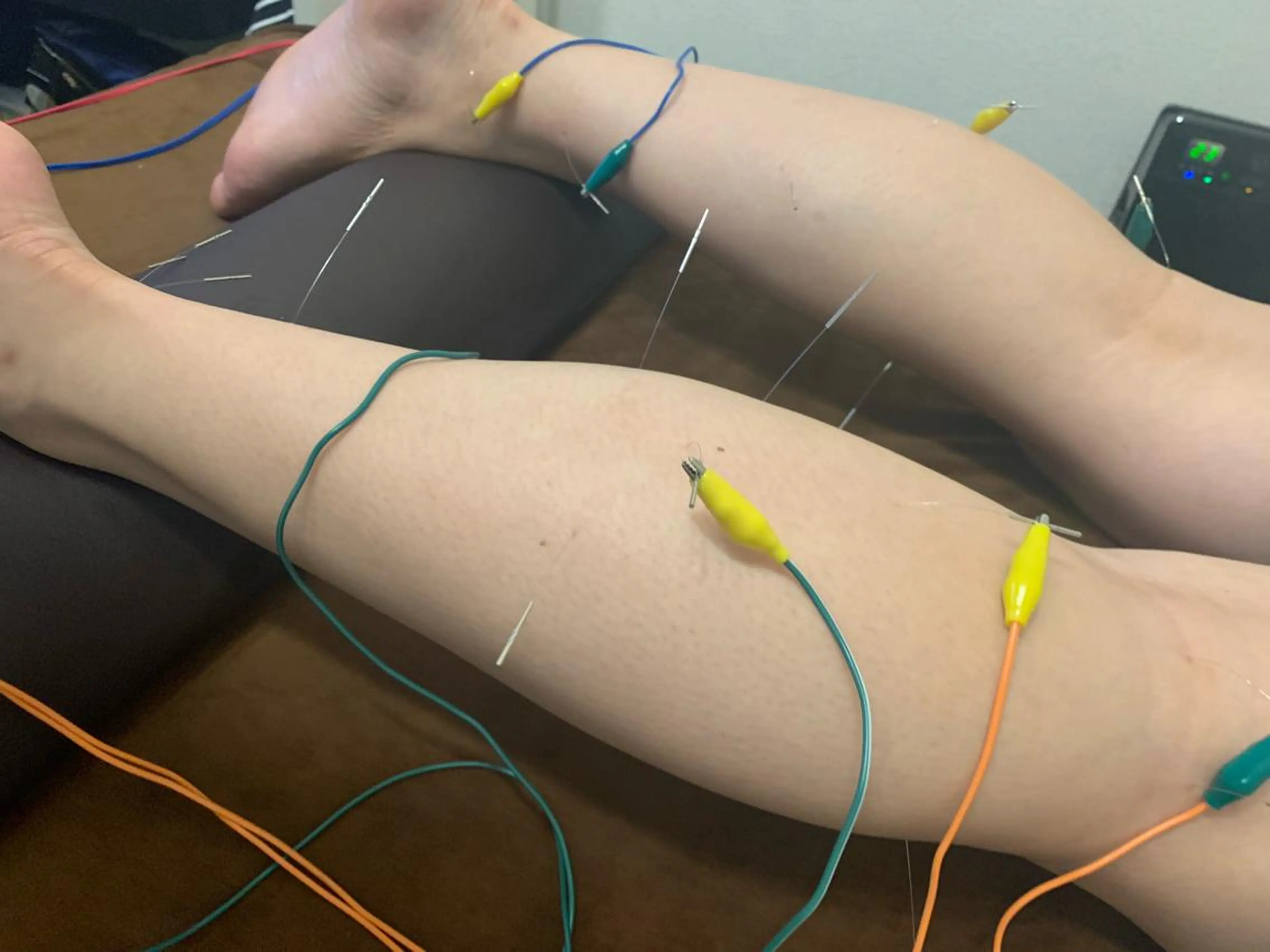 表参道鍼灸院K 美容鍼🔮ララピールのエステ・リラクイメージ