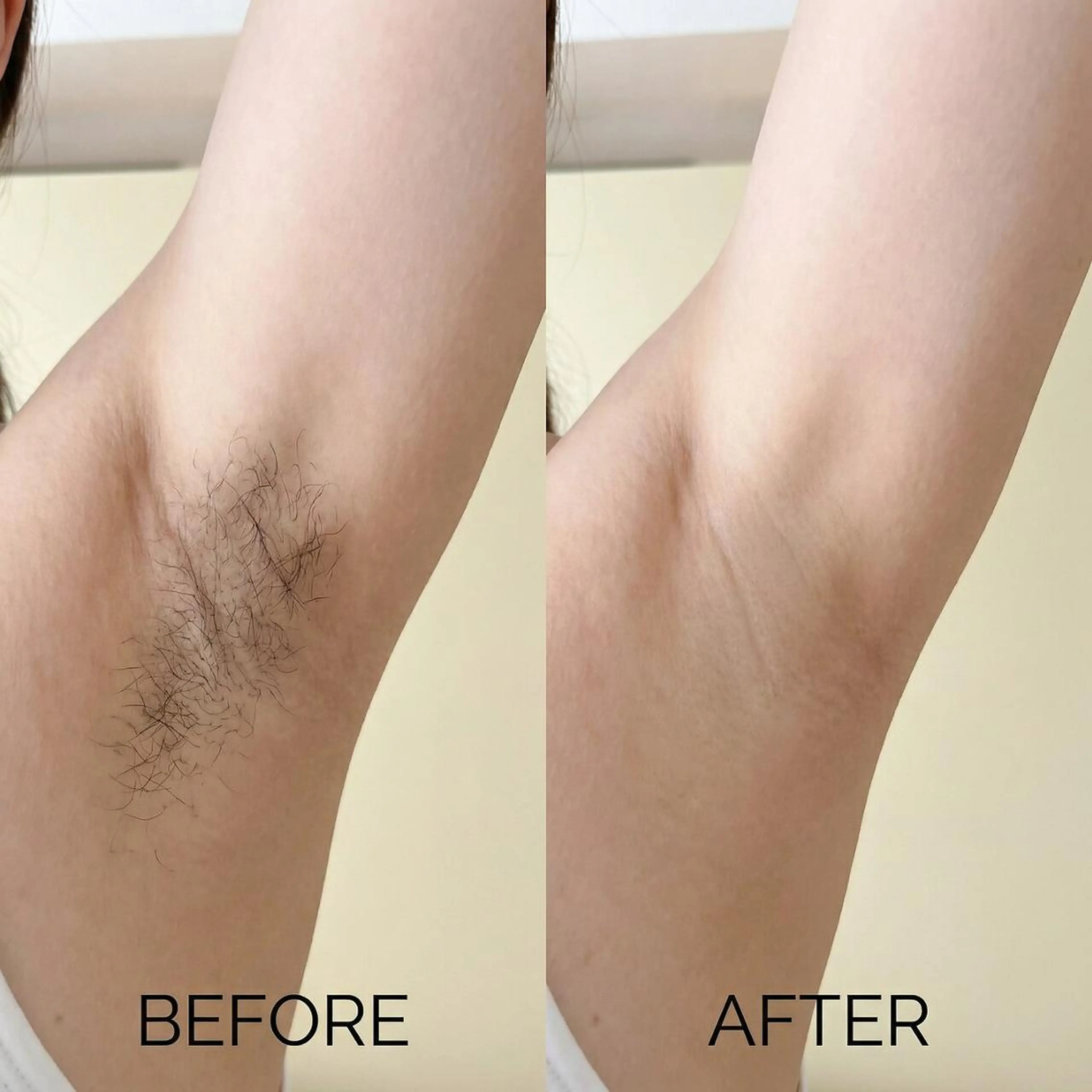 脱毛 脱毛×肌管理サロン ルネルのエステ・リラクイメージ