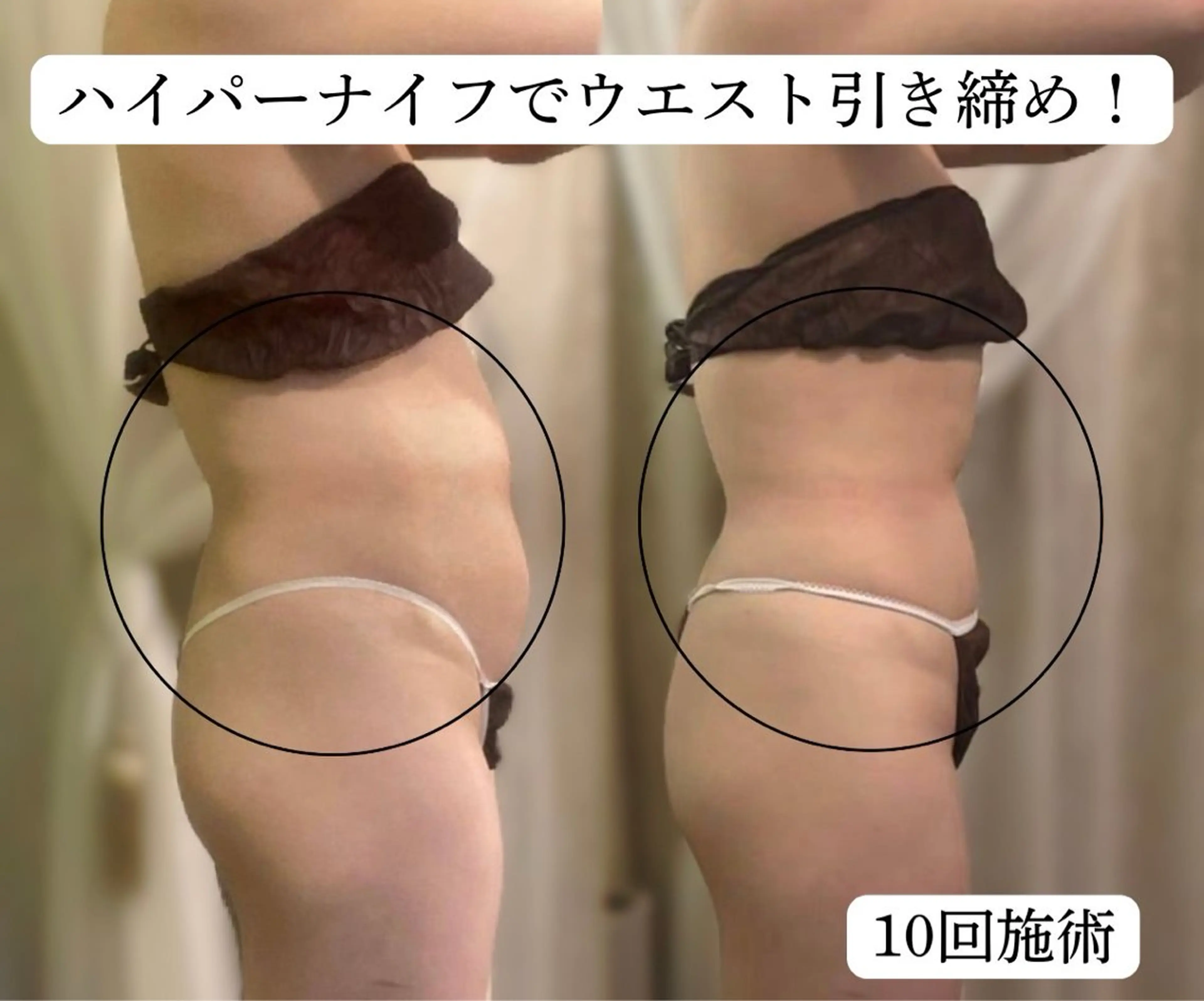 サロンハート浦和店所属・痩身小顔サロンハート 浦和店のエステ・リラクイメージ