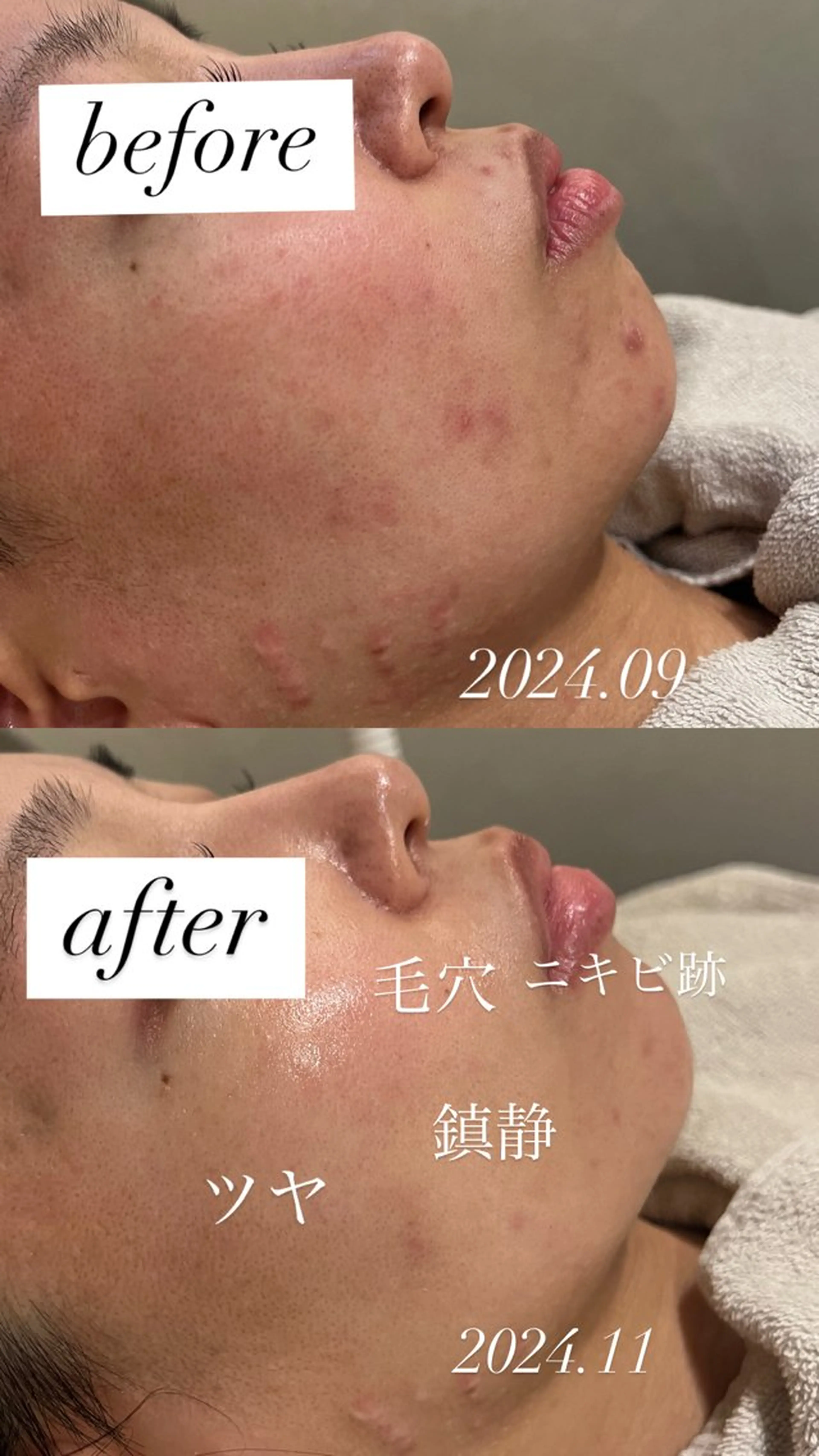 エステ リラク 【vidyto】ヴィディトゥ所属・肌管理サロン vidyto　MOEのエステ・リラクイメージ