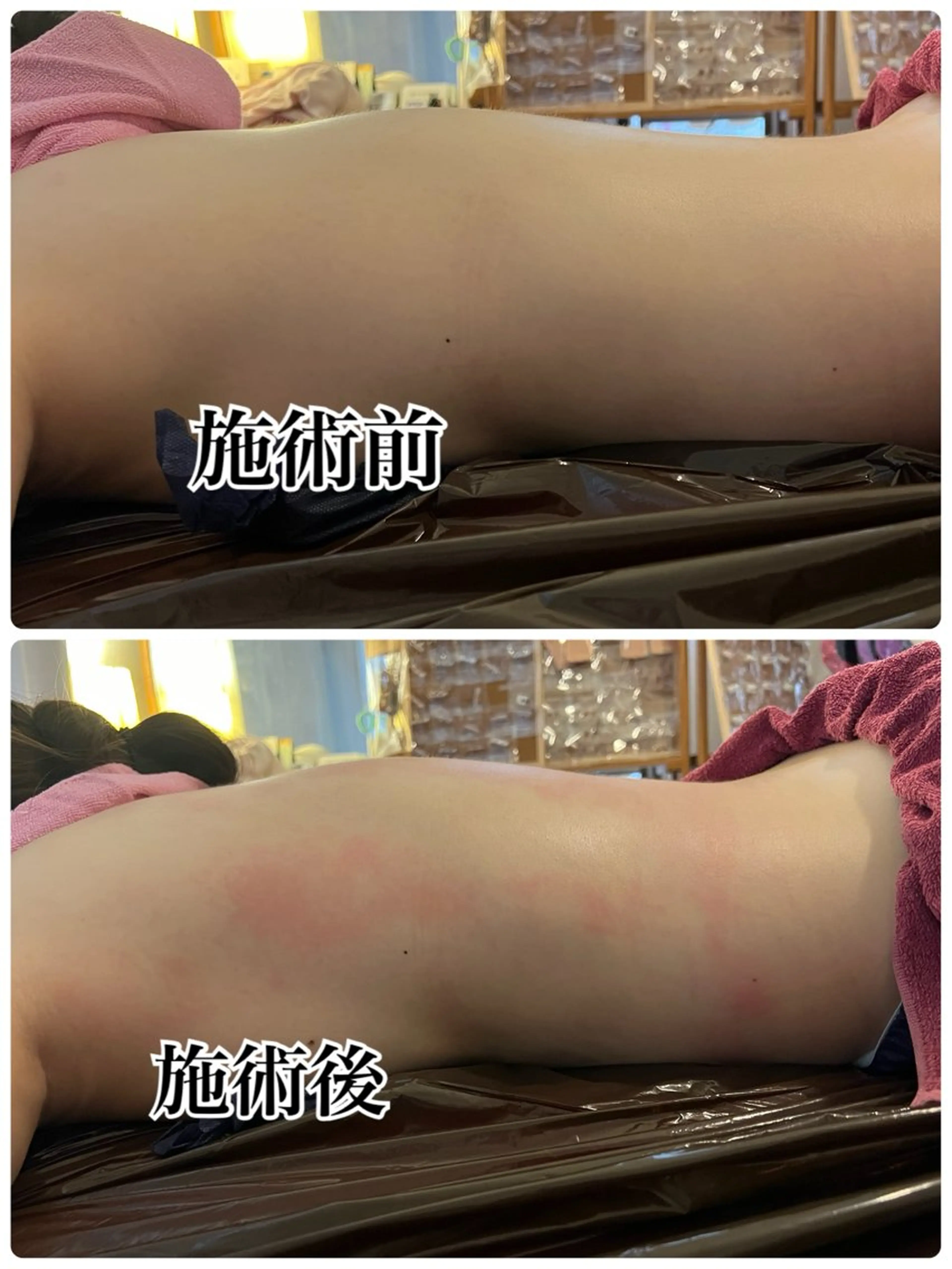 ❤︎MN❤︎ モンのエステ・リラクイメージ