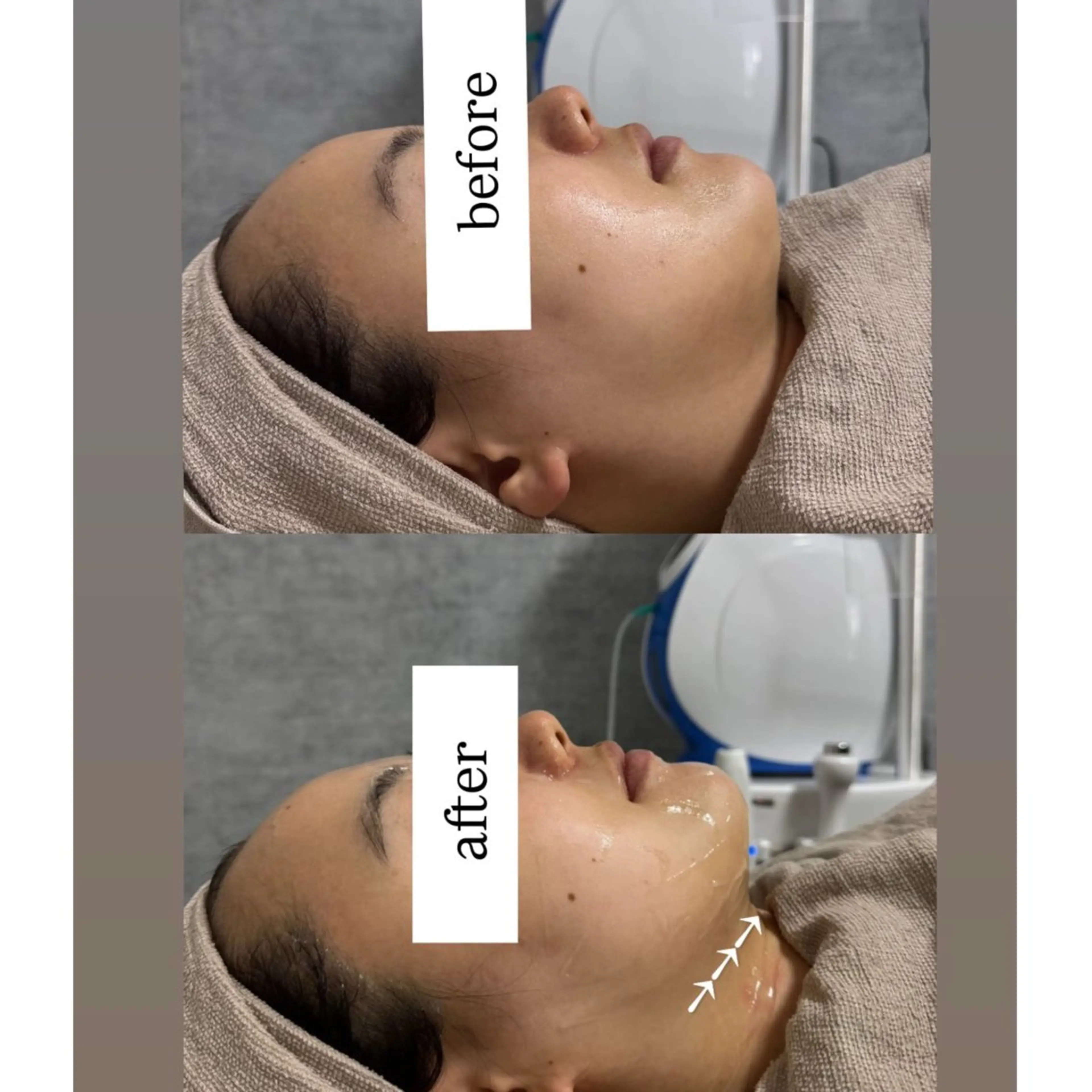 エステ crescent所属・【韓国肌管理・脱毛】 クレセントのその他イメージ