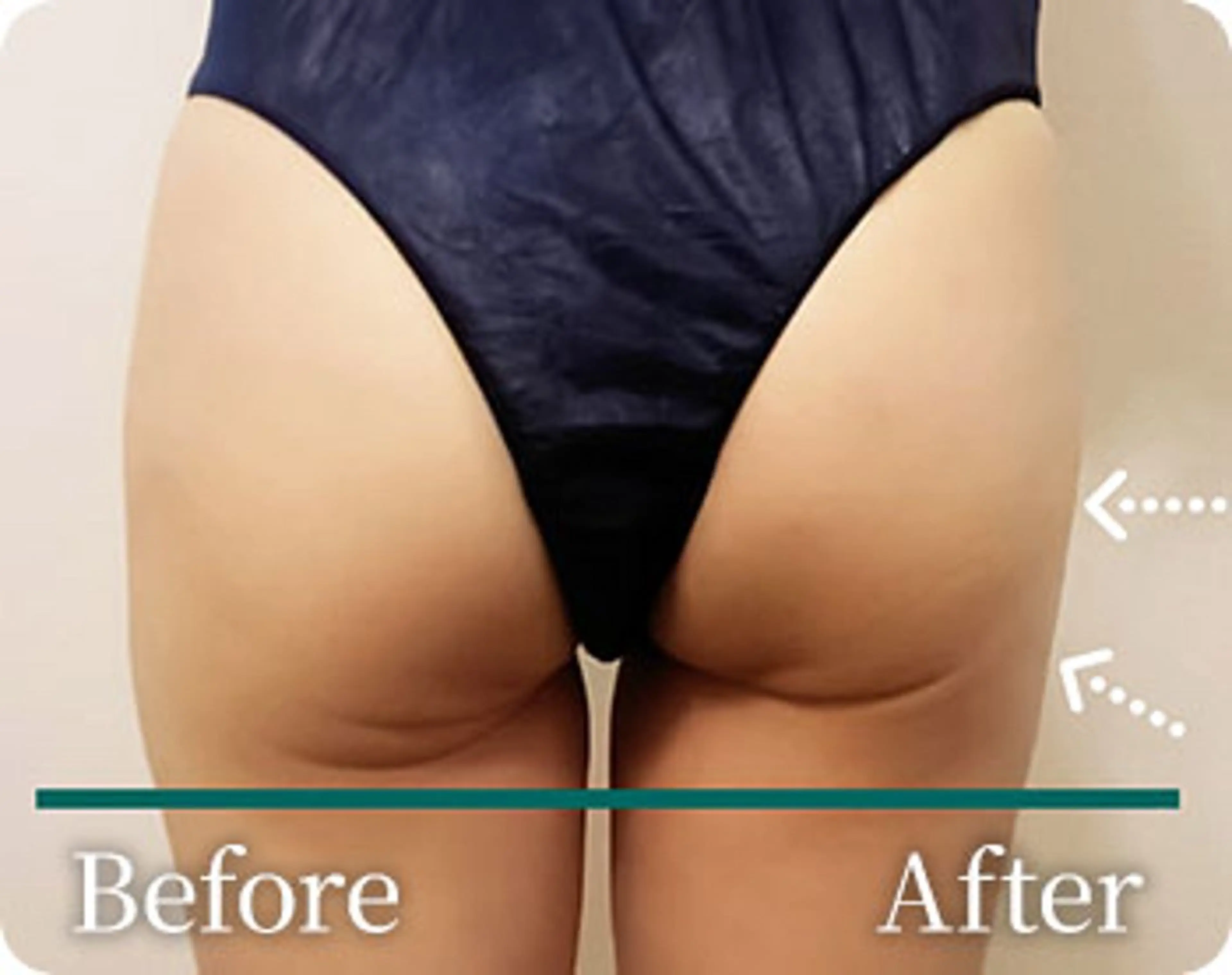 その他 本気で痩せたい方へ 痩身専門サロンのエステ・リラクイメージ