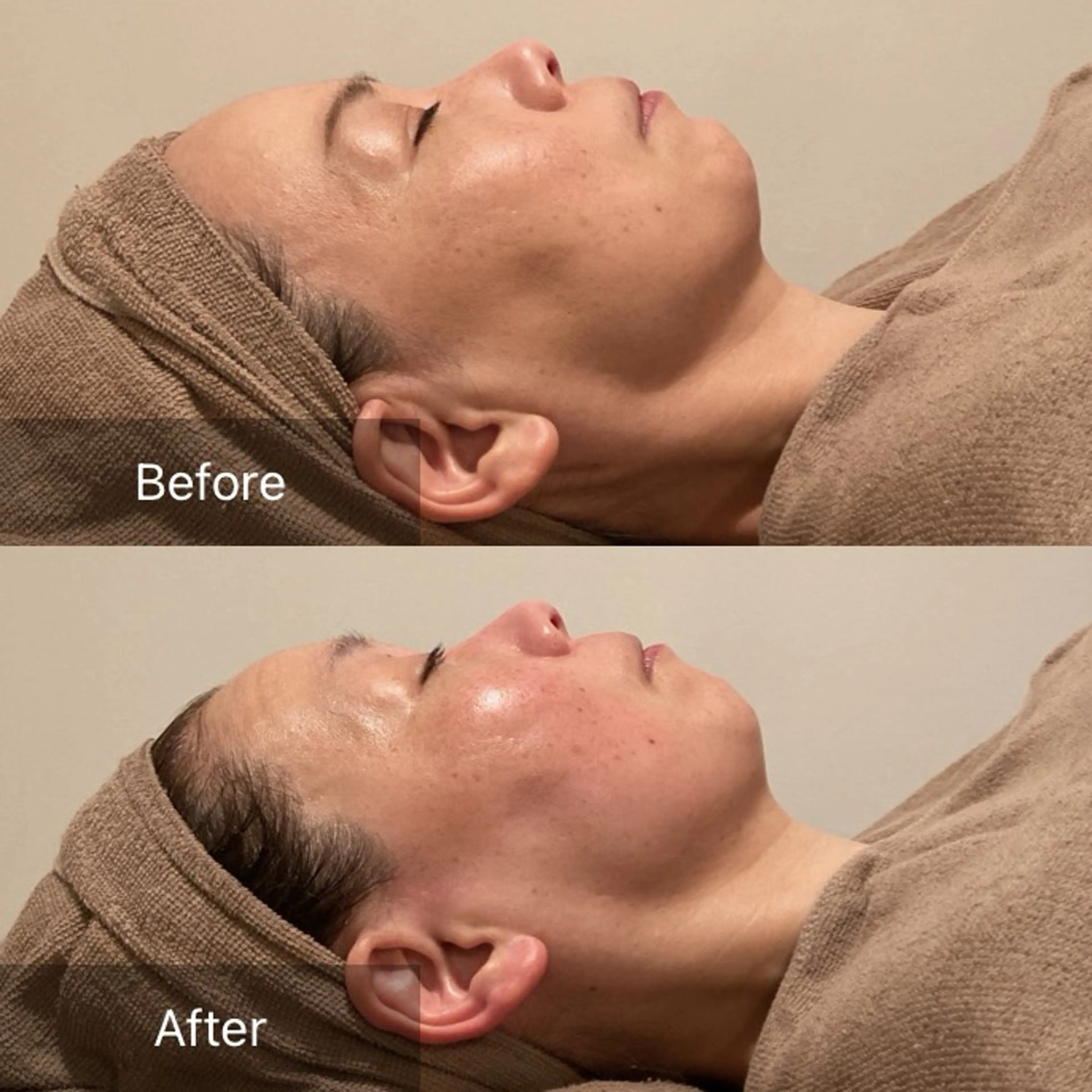 エステ リラク Ｂ&H所属・頭痛•肩こり専門/ 眉サロンB&H心斎橋のエステ・リラクイメージ