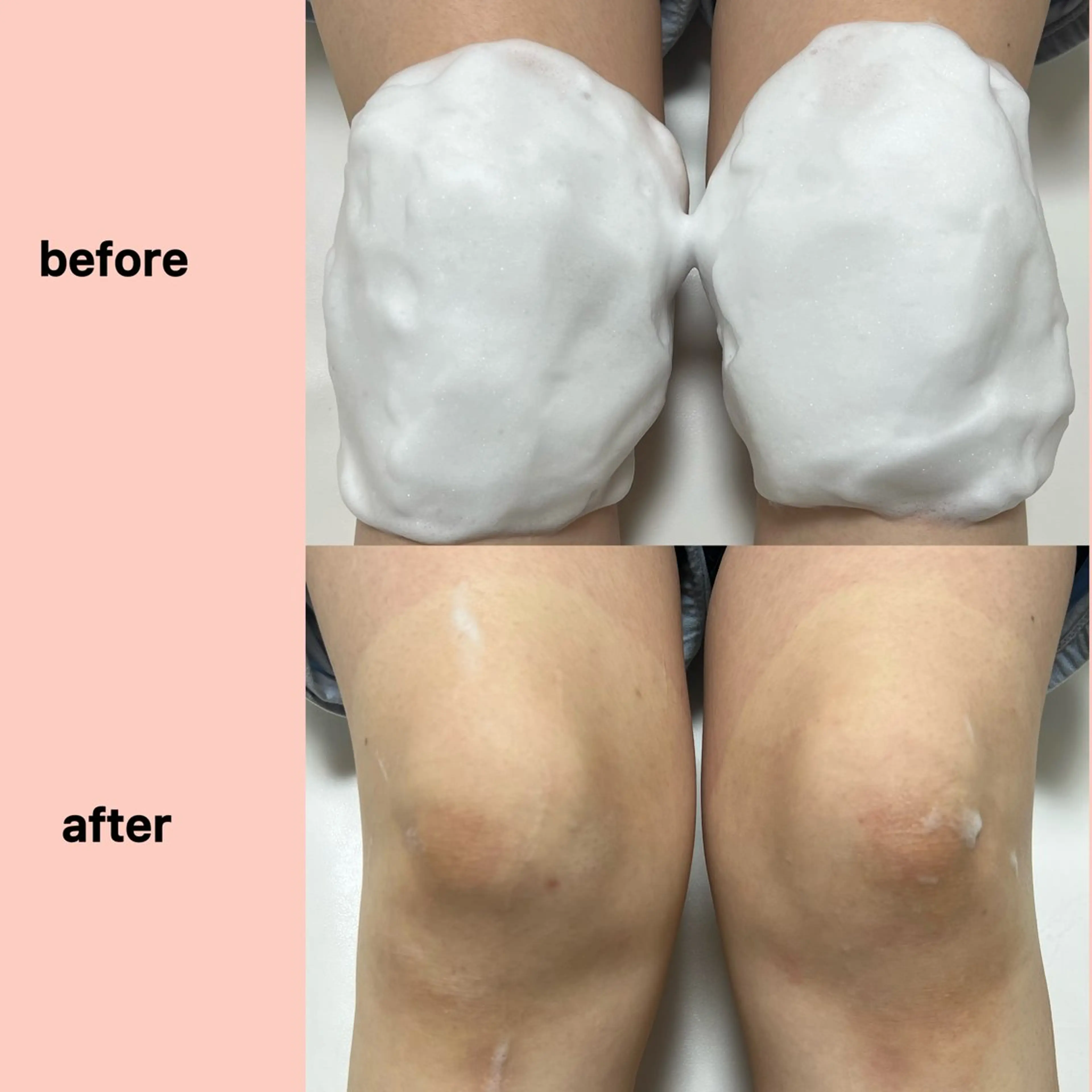 エステ gleam ü 枚方公園のエステ・リラクイメージ