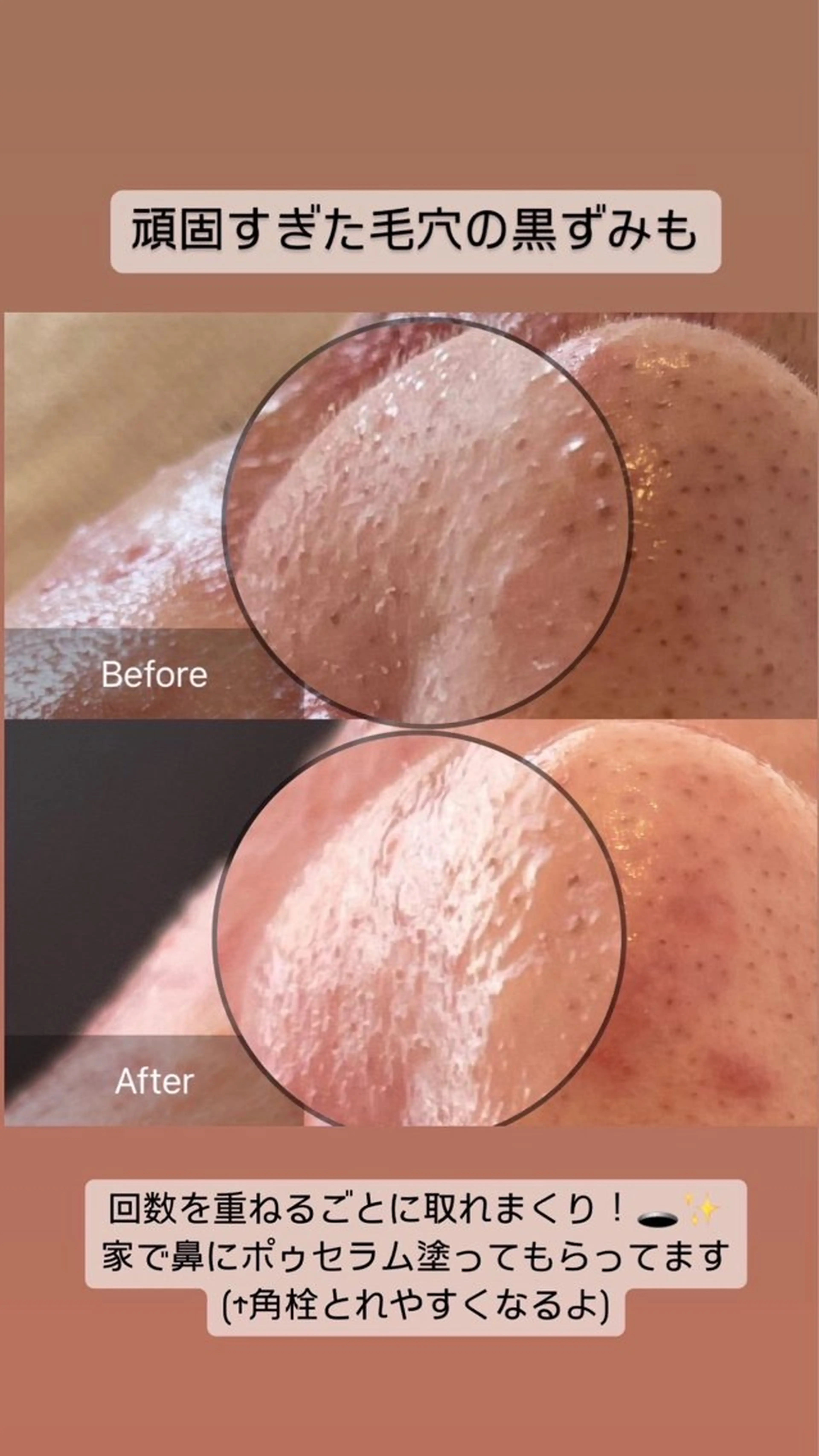 エステ リラク nouvelle  plume所属・ヌーベル プリュムのエステ・リラクイメージ