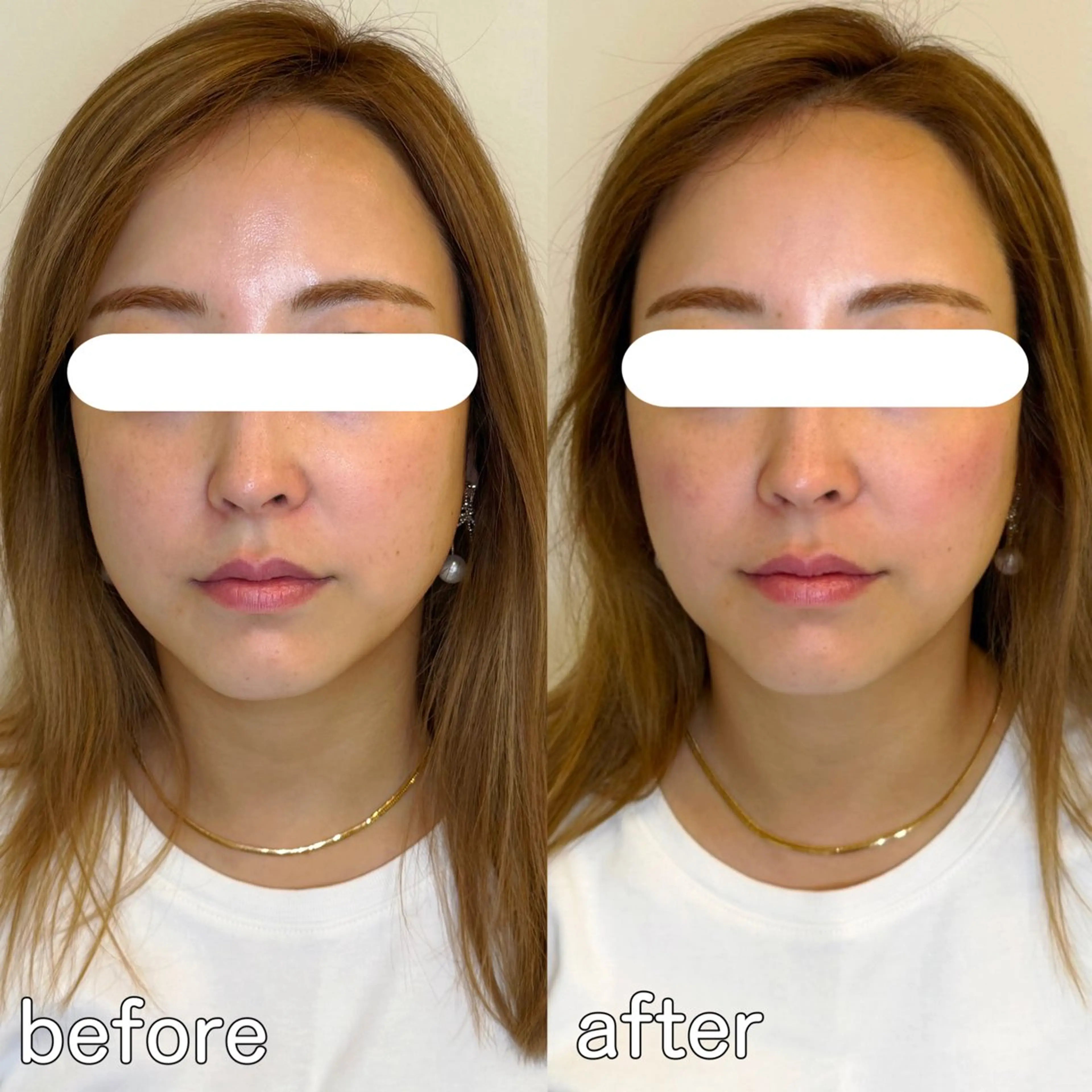 小顔矯正&美容整体 整え屋REDオーナーのエステ・リラクイメージ