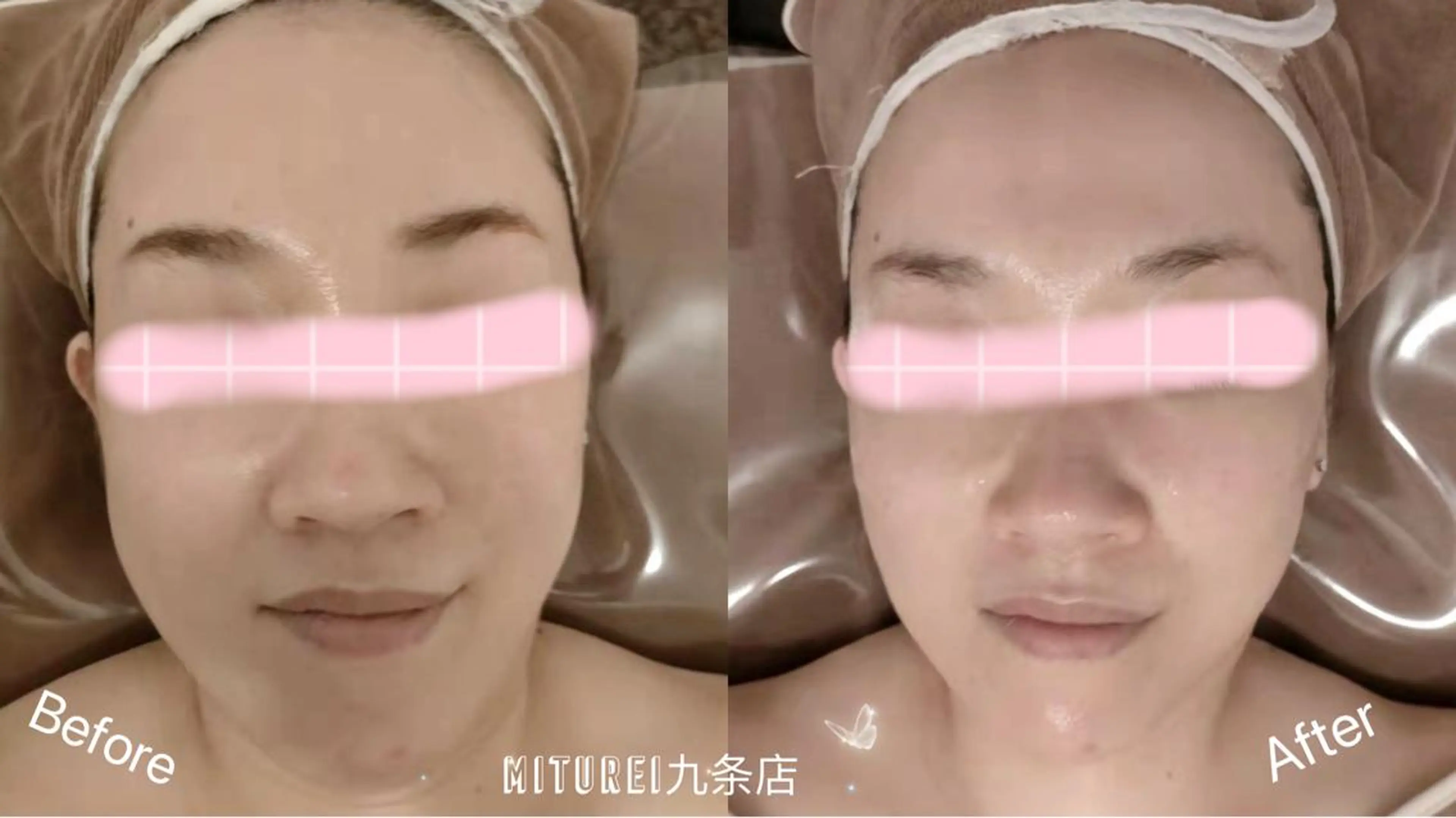 西区九条エステ MITUREIサロンのエステ・リラクイメージ