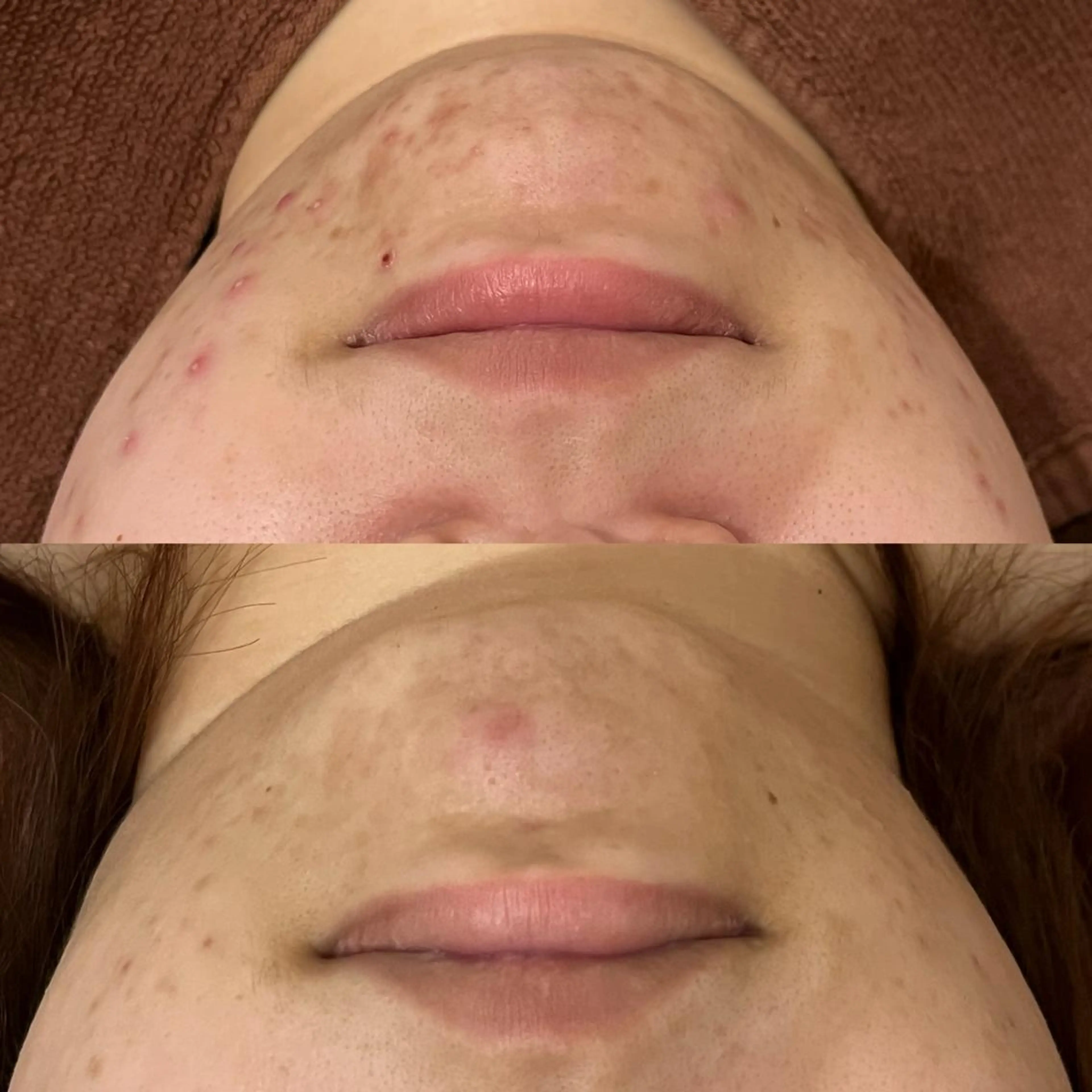 触れたくなる モテ肌へ...❤︎のエステ・リラクイメージ