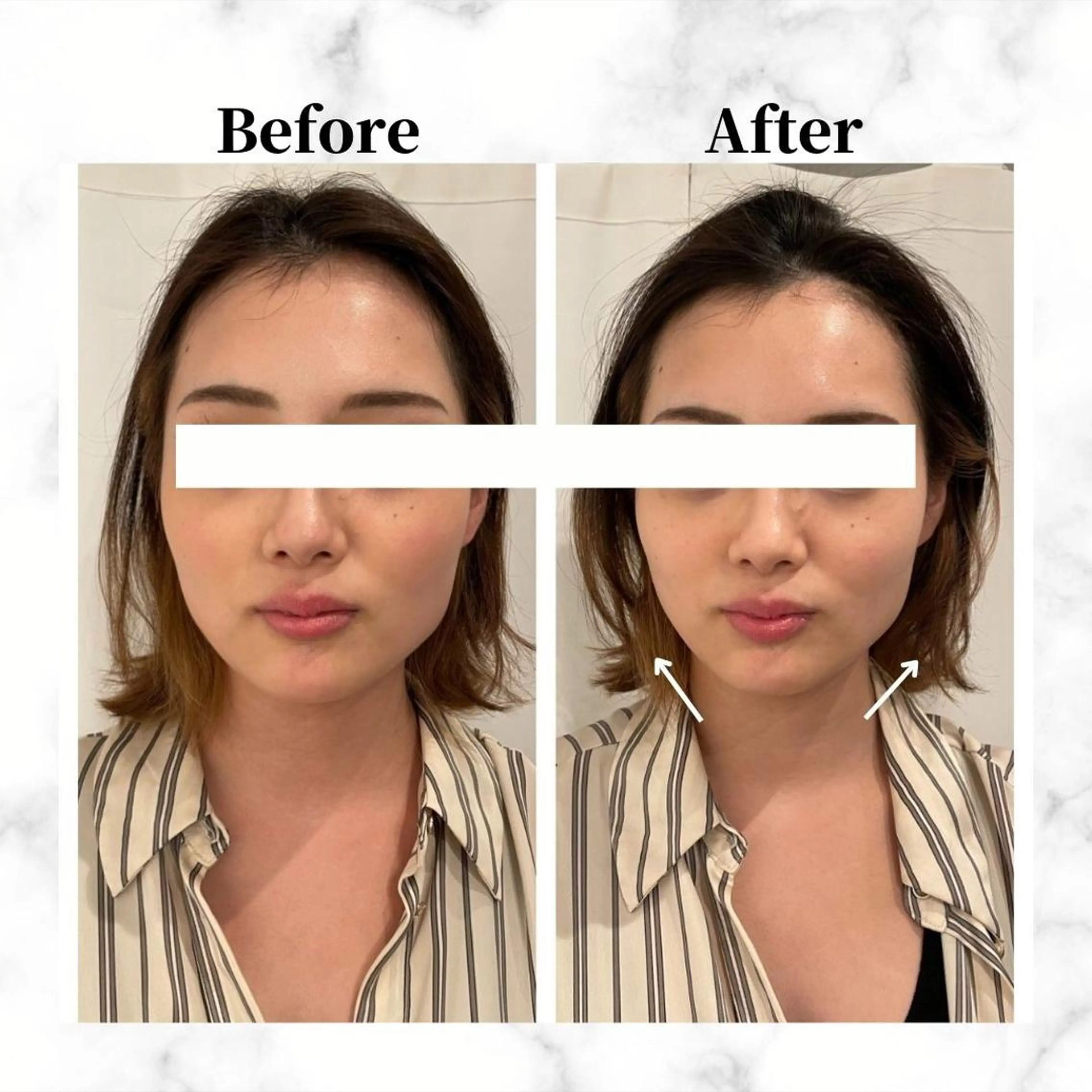 エステ リラク 12Dハイフ💗 最強小顔のエステ・リラクイメージ