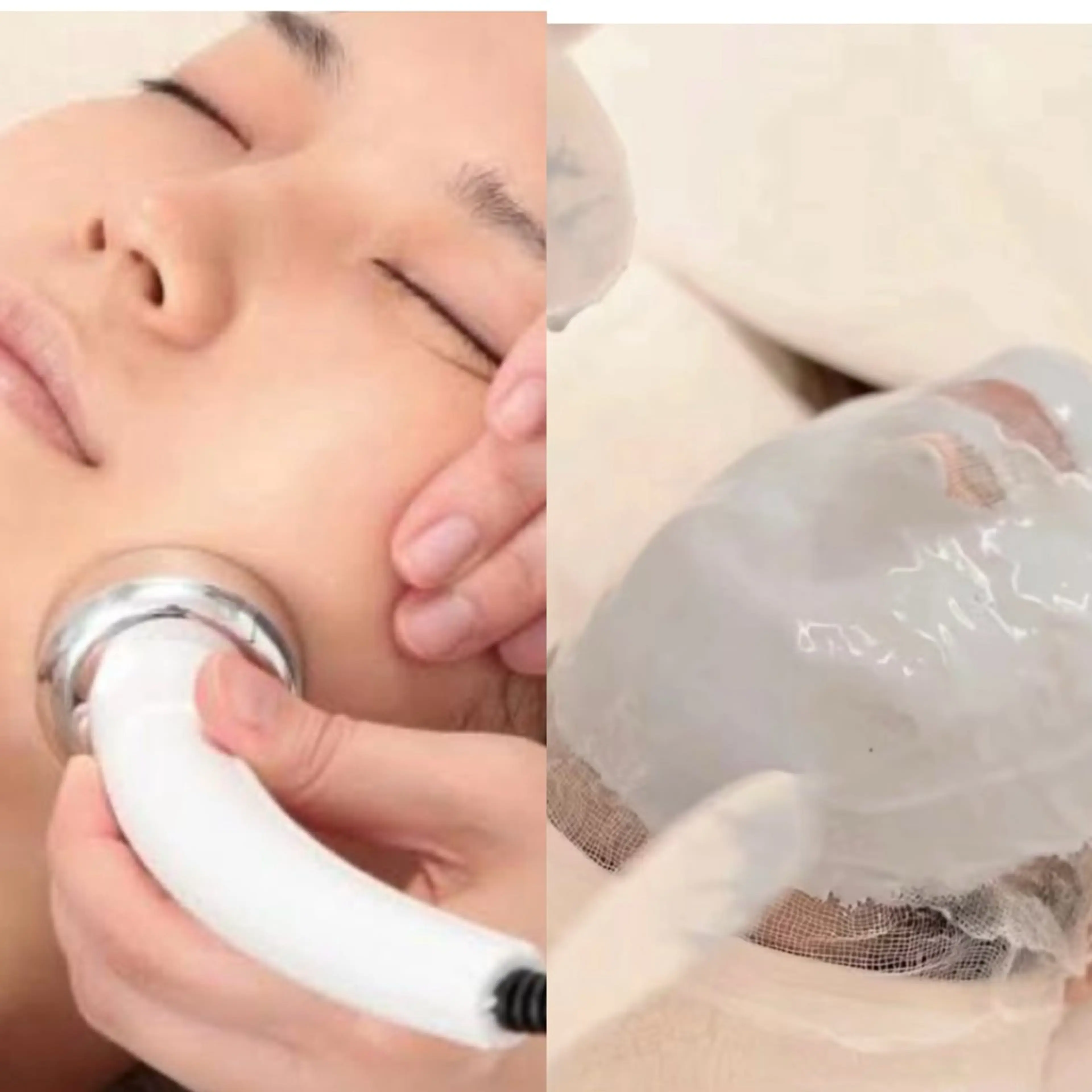 🉐SALE🉐小顔❤️ キメ整🥚たまご肌★角質ピーリング+ハイドラ鼻+超音波リフト+小顔+パック💚 60¥3990の写真