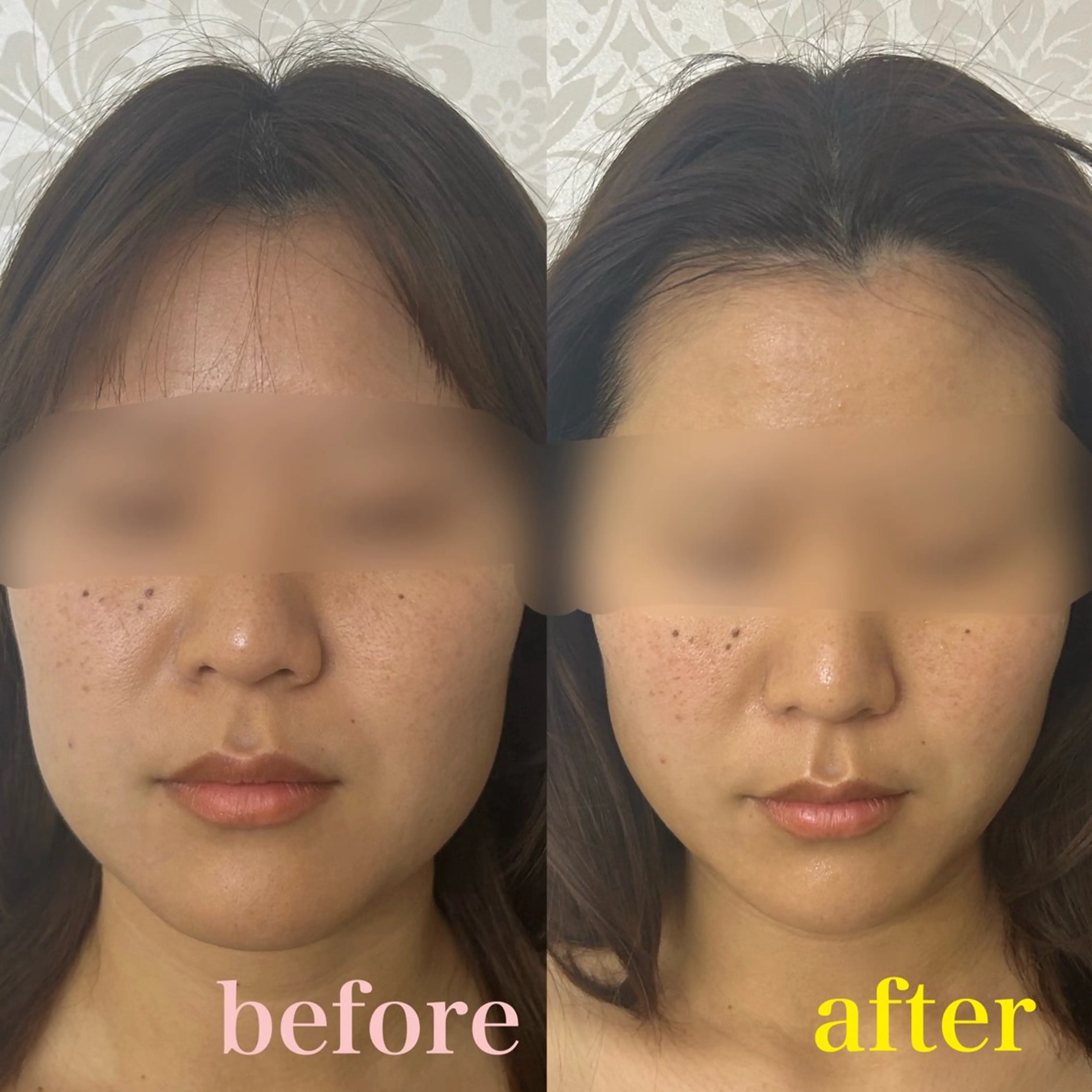 エステ フェイシャルサロン CHIARA 荒田のエステ・リラクイメージ