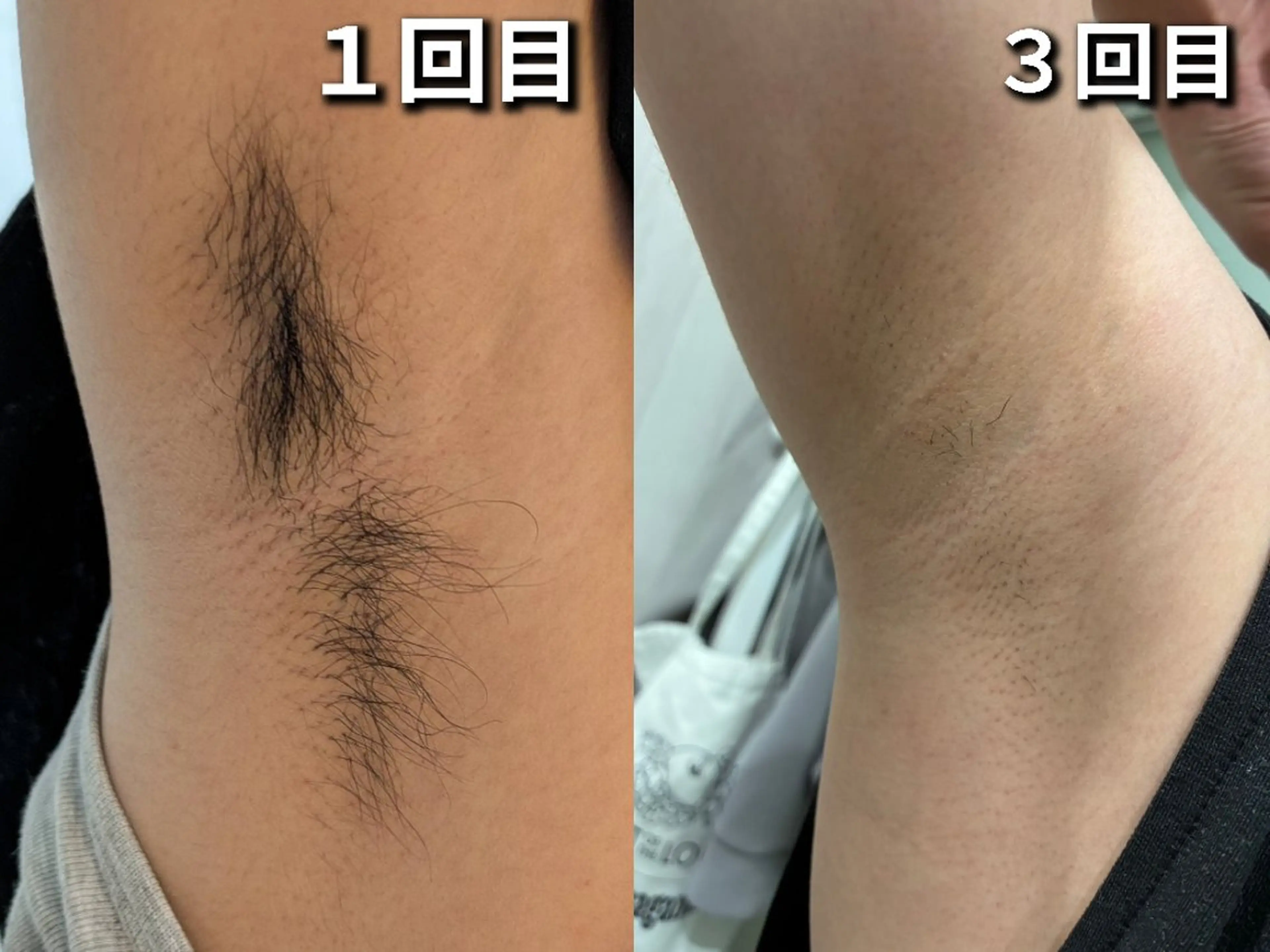 キッズ エスティックサロン Moon-bell所属・エステティクサロン Moon-bellのエステ・リラクイメージ