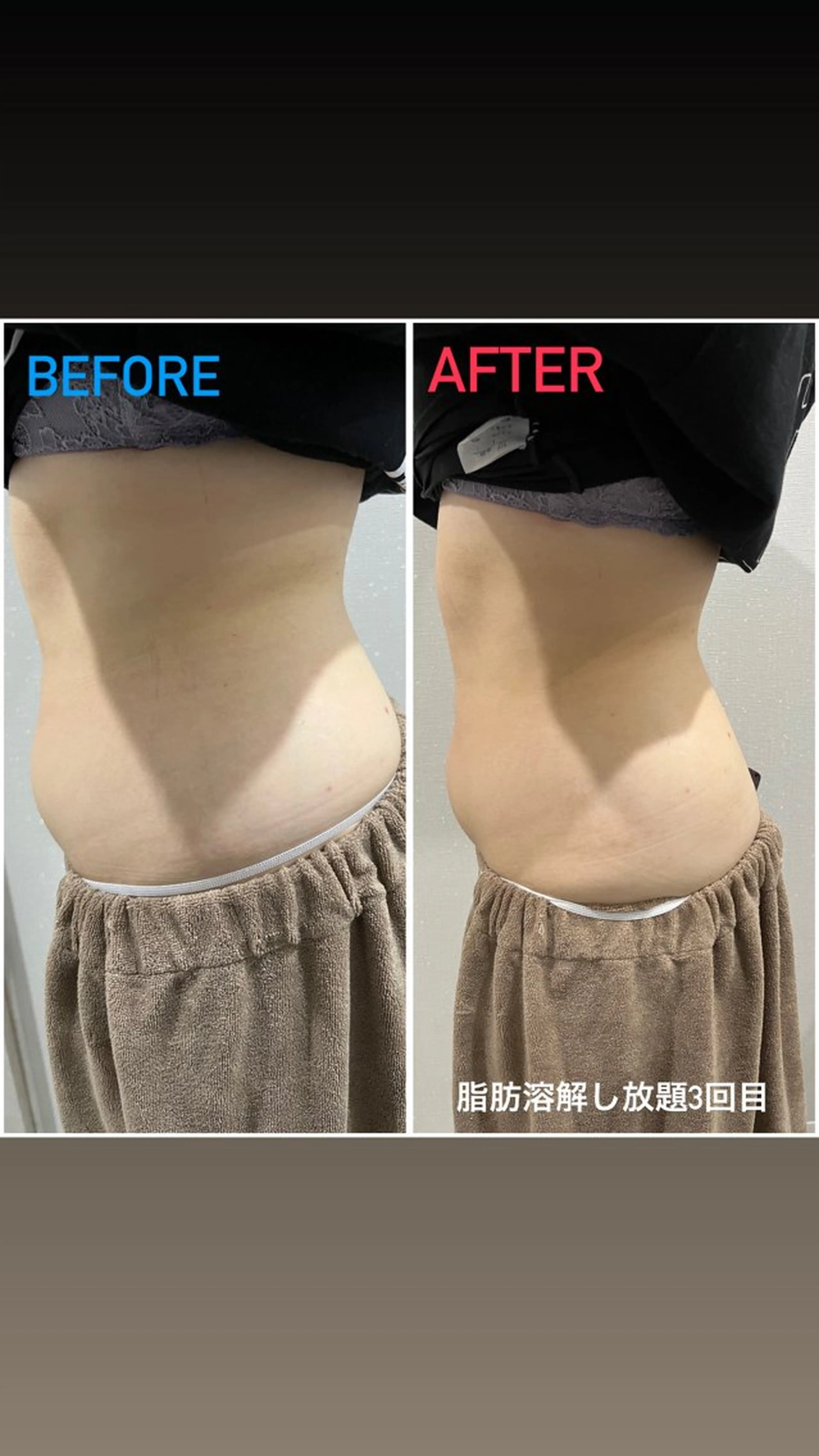 エステ アルカンジュ~archange~所属・痩身/毛穴洗浄/脱毛 アルカンジュのエステ・リラクイメージ