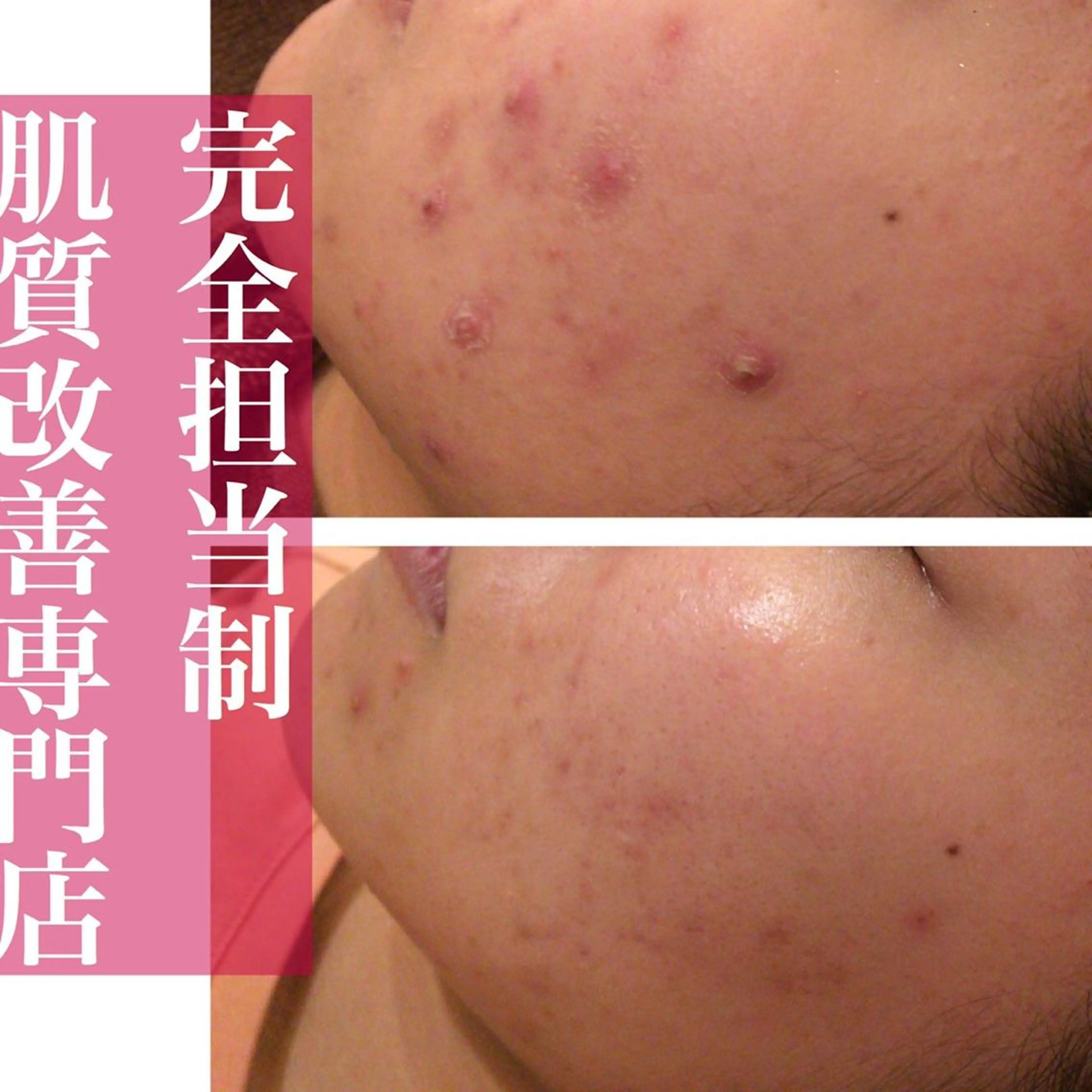 ミディアム カラー パーマ ヘアアレンジ メンズ キッズ ネイル マツエク・マツパ エステ リラク ニキビ・肌質改善専門 ♡人生が変わるサロンのエステ・リラクイメージ