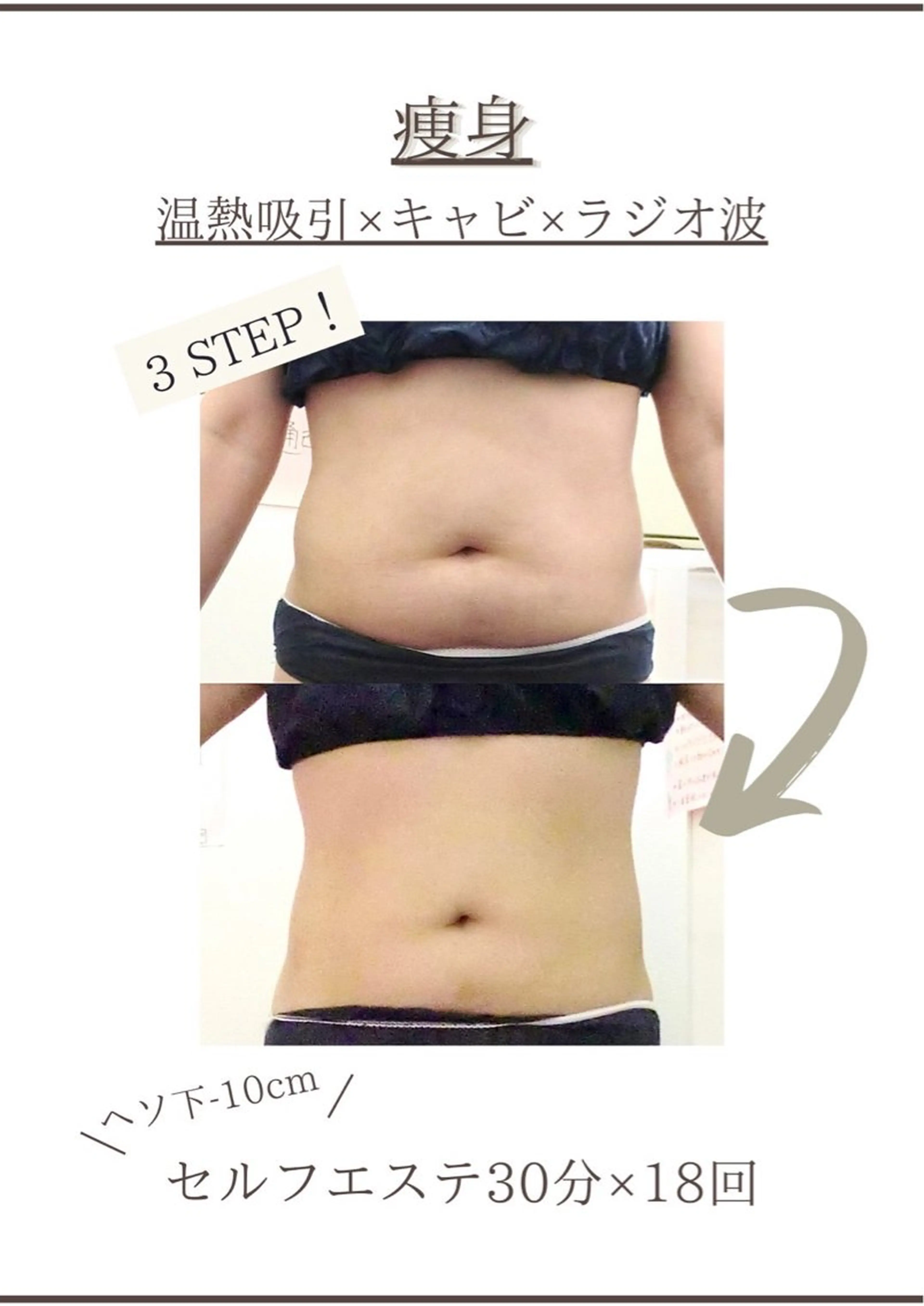 エステ SELF  BEAUTY gracia浦添店所属・gracia 浦添店のその他イメージ