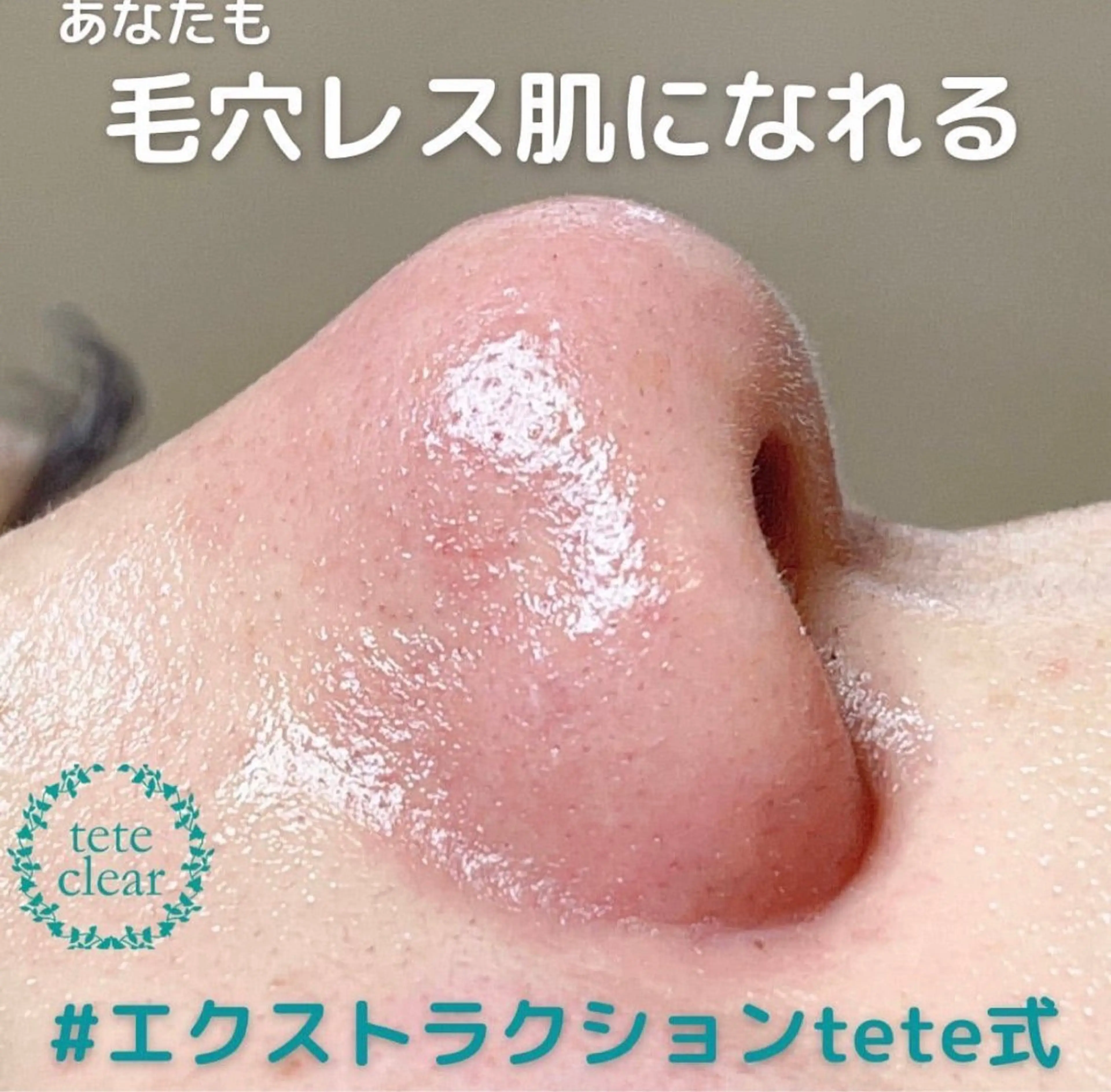 【毛穴専門店】 瑞江|yukaのエステ・リラクイメージ