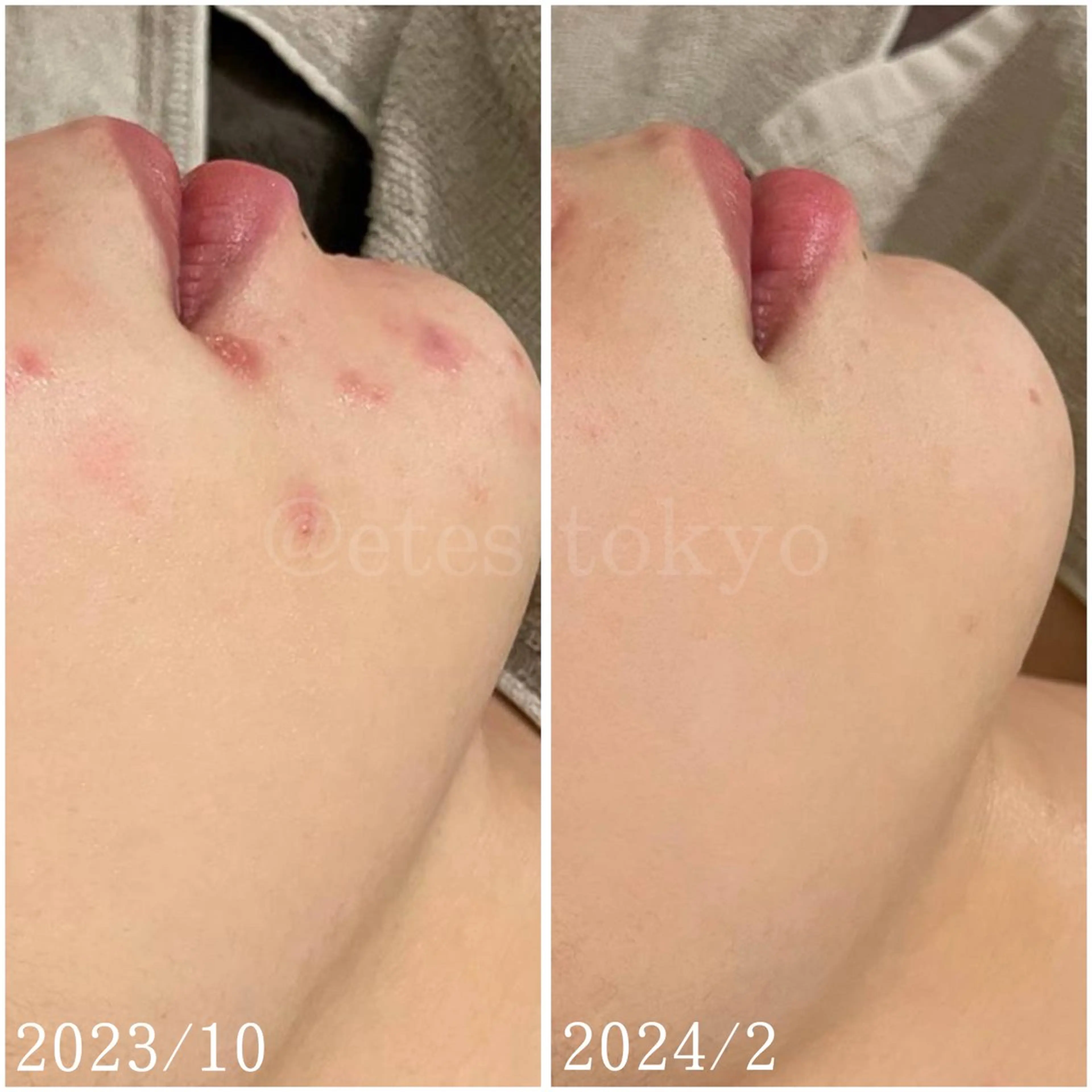 etes （エトエス）所属・etes.tokyo 中目黒のエステ・リラクイメージ