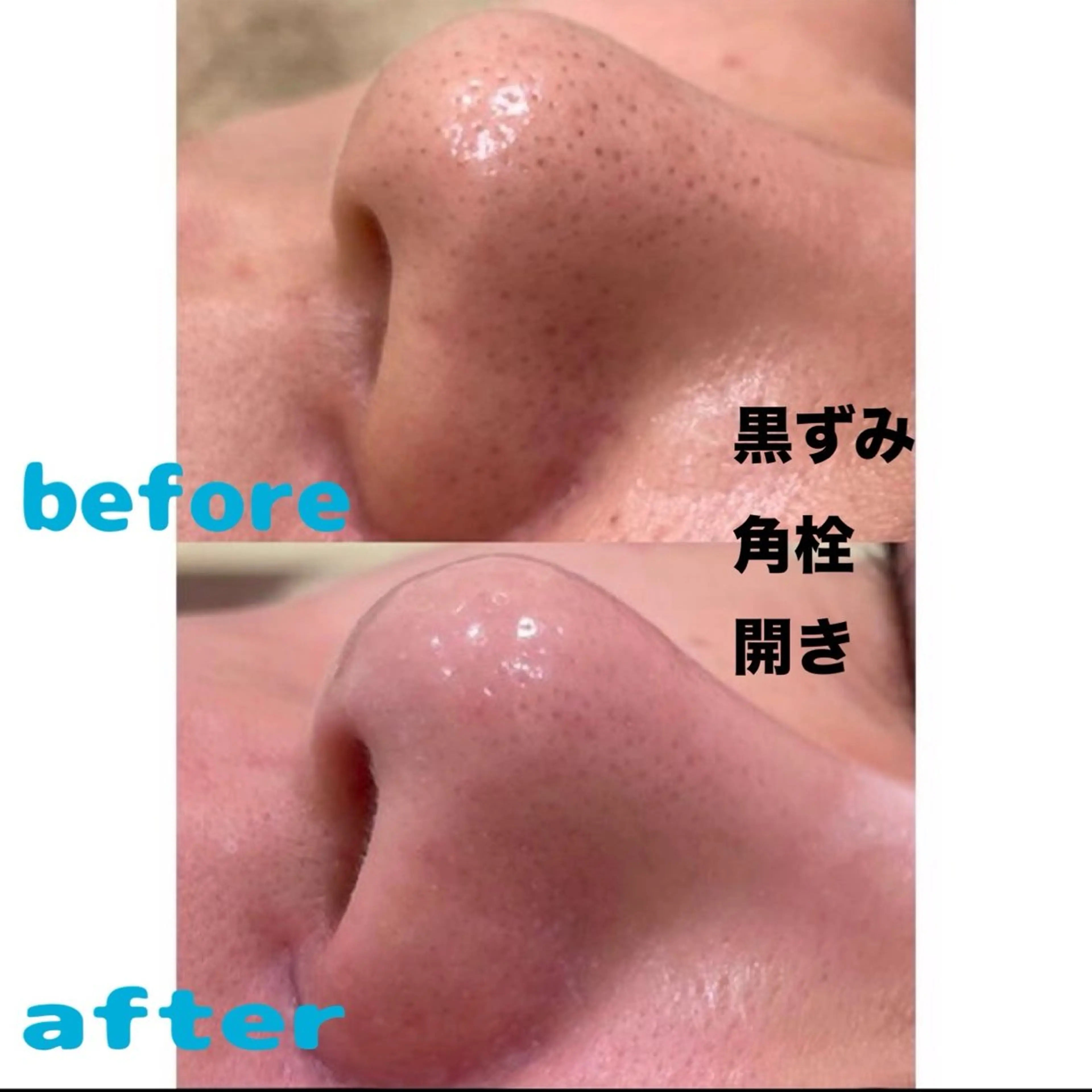 エステ atelier Bellemu所属・【錦糸町】アイブロウ リスト🌷ホノカの眉毛・アイブロウイメージ