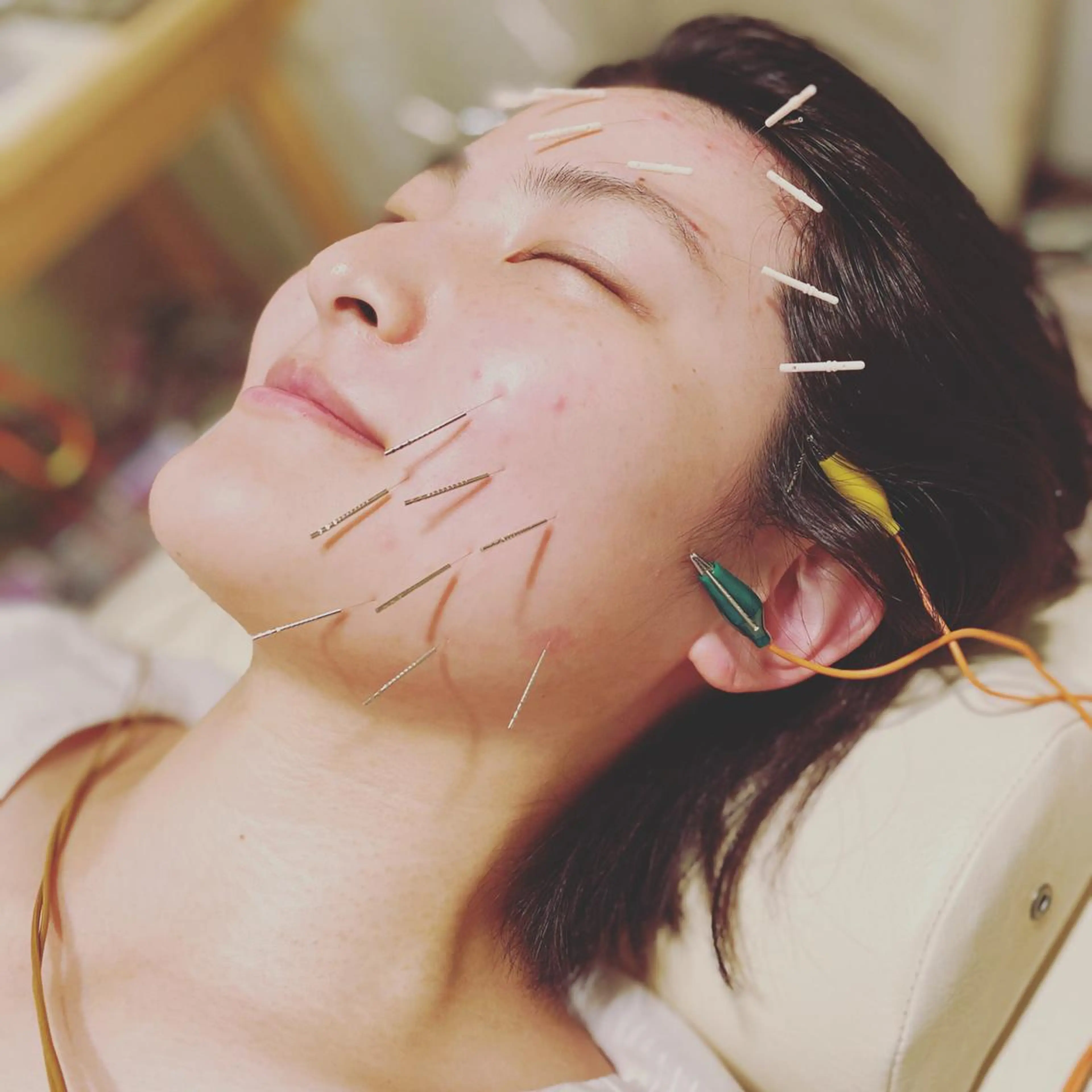 むくみたるみ専門☆ 美容鍼・小顔矯正のエステ・リラクイメージ