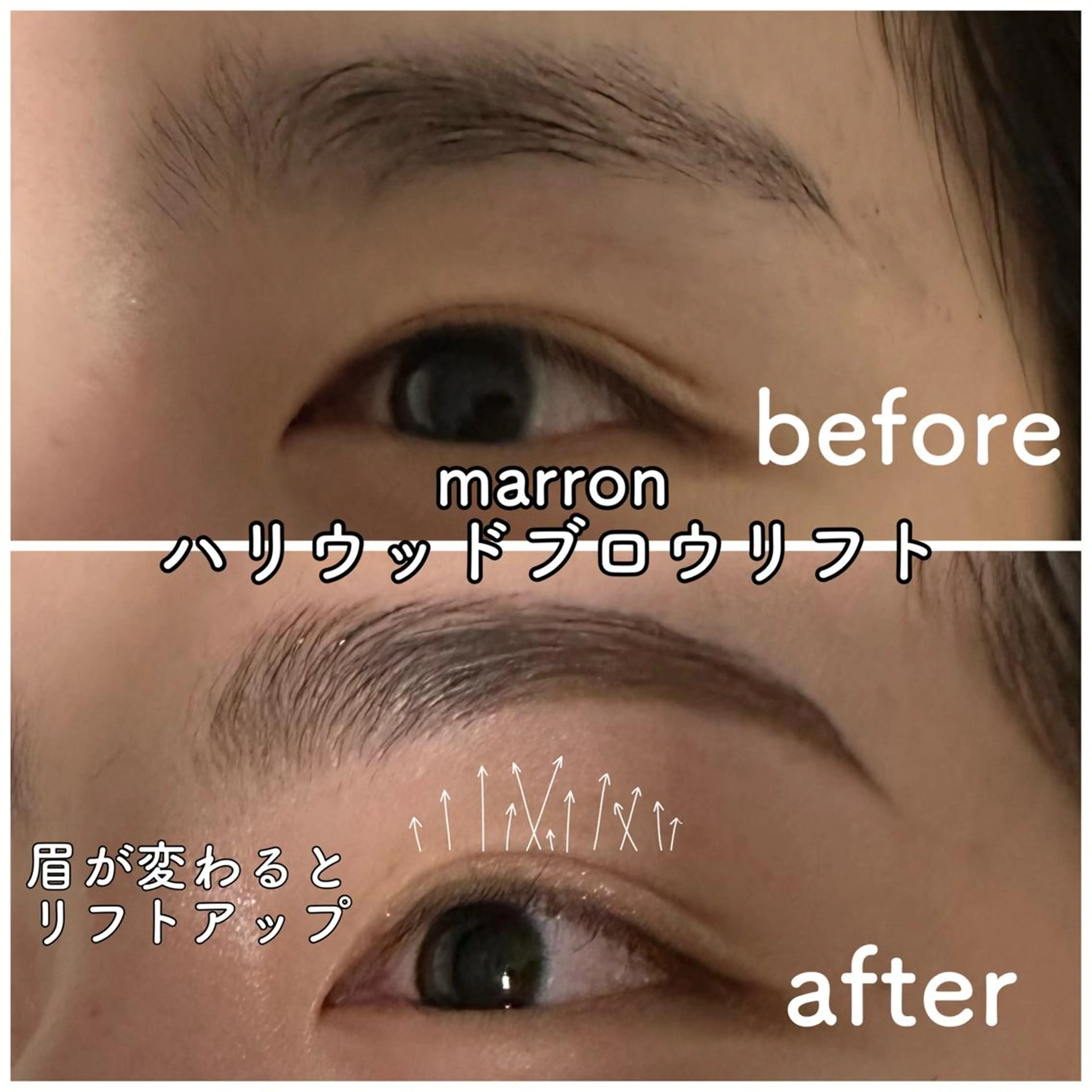 marron所属・痩身ハイパーナイフ ララピールリアボーテのエステ・リラクイメージ