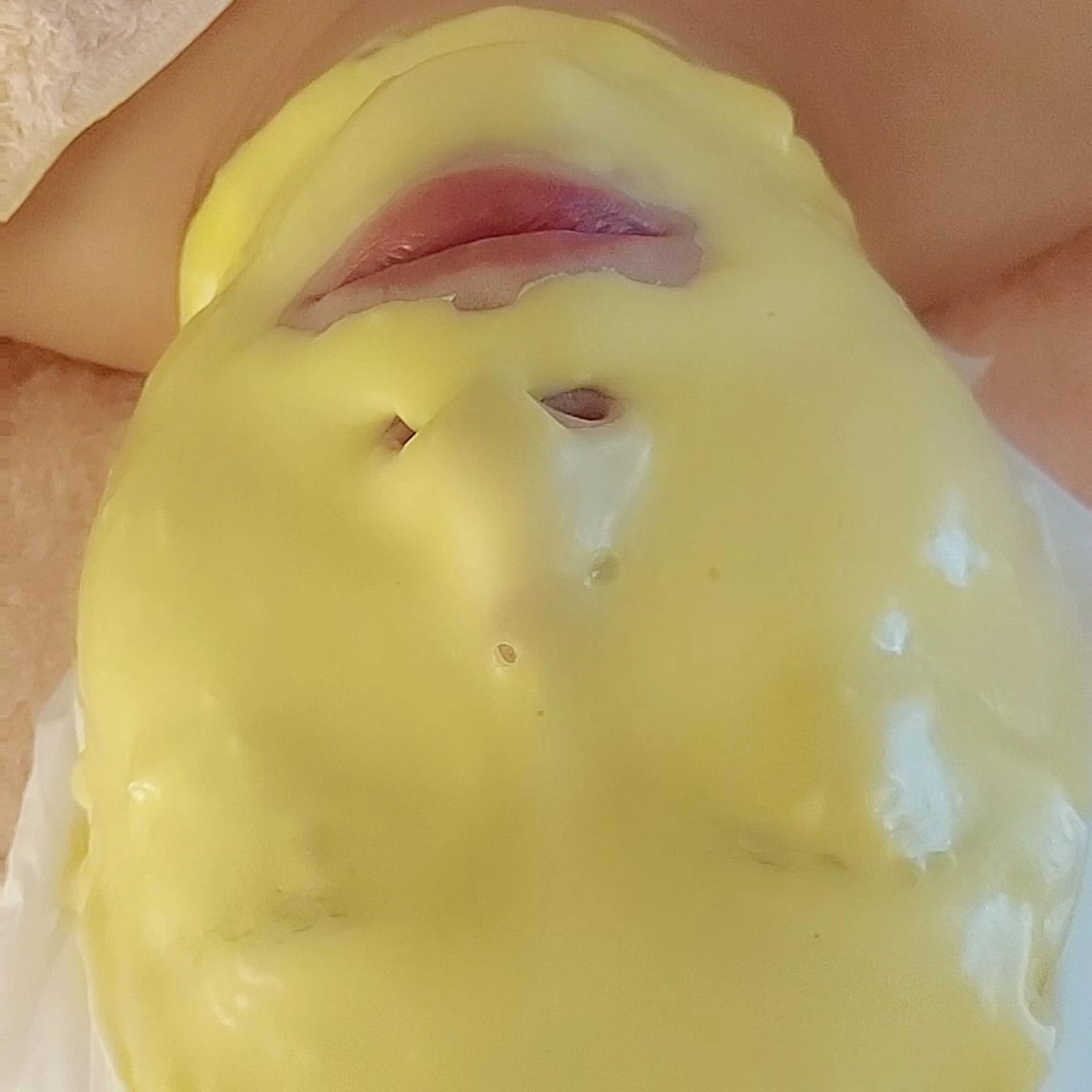 スタンダードコース+ビタミンパックの写真