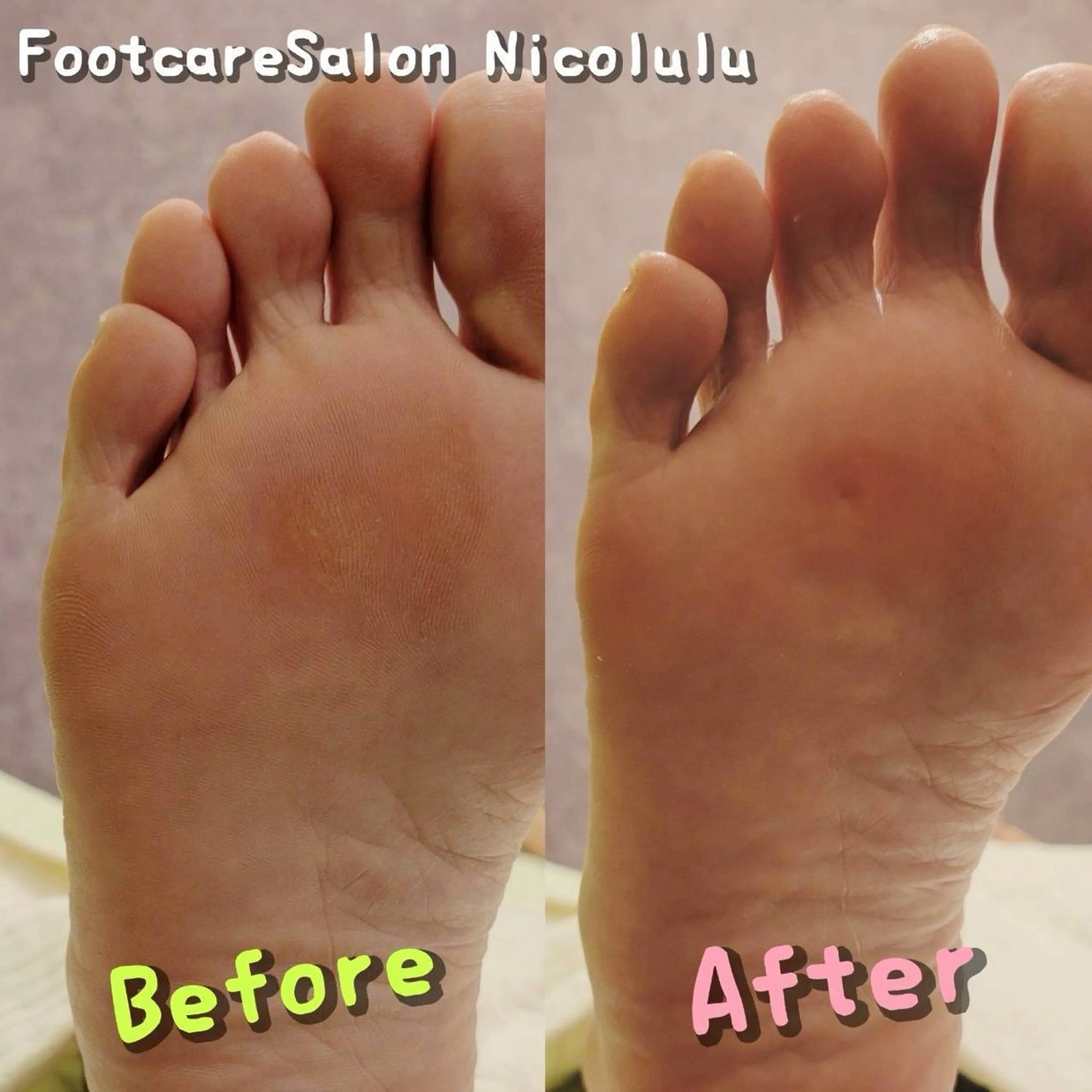 リラク 足トラブル専門 ニコルル金沢のエステ・リラクイメージ