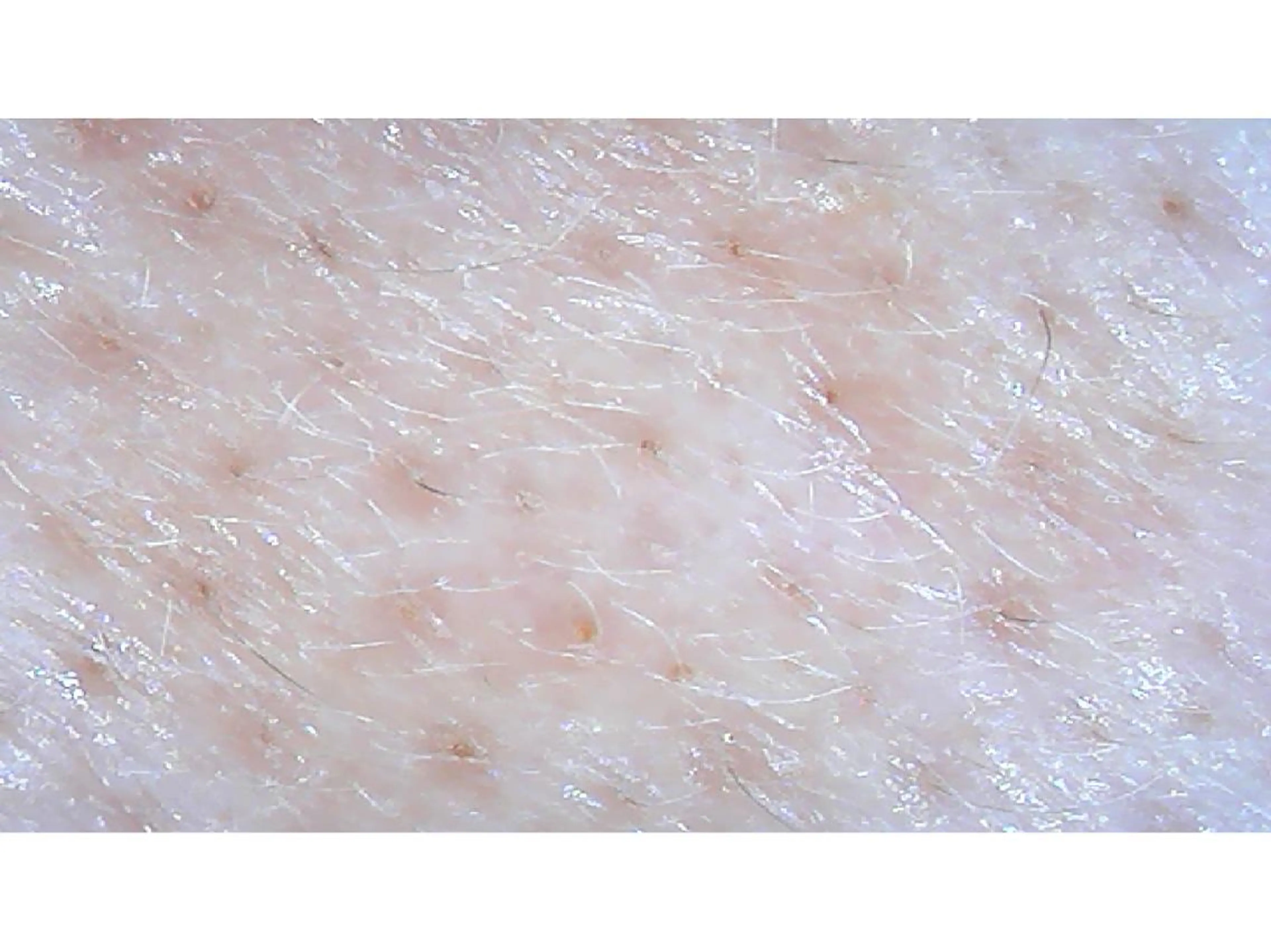 エステ リラク 宮野 麻綺のエステ・リラクイメージ